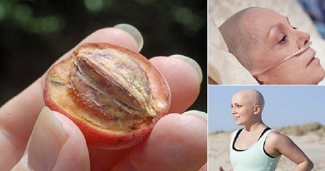 Cancer Cure: These 4 Plants Kill 75% Of Cancer Cells And Are Much More Effective Than Other Cancer Treatments CanceR