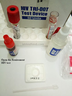 Open the requirement HIV test