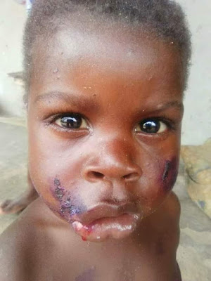 4 Photos: See what a heartless father did to his 3-year-old child for defecating in the bedroom