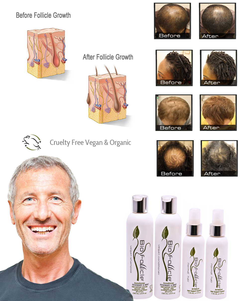 Vegan Hair Product An Effective Hair Regrowth with Hair Growing Products