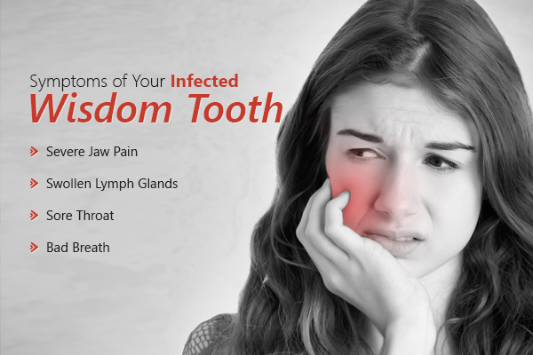 Symptoms of Your Infected Wisdom Tooth