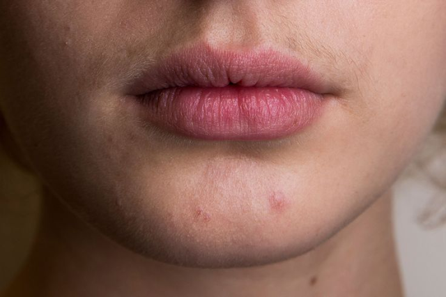 губы мужские. вертикальный лабрет пирсинг. скарлетт йоханссон септум. волосы под губой. волосы под губой.