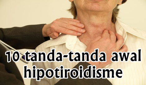 10 TANDA-TANDA AWAL PENYAKIT HIPOTIROIDISME