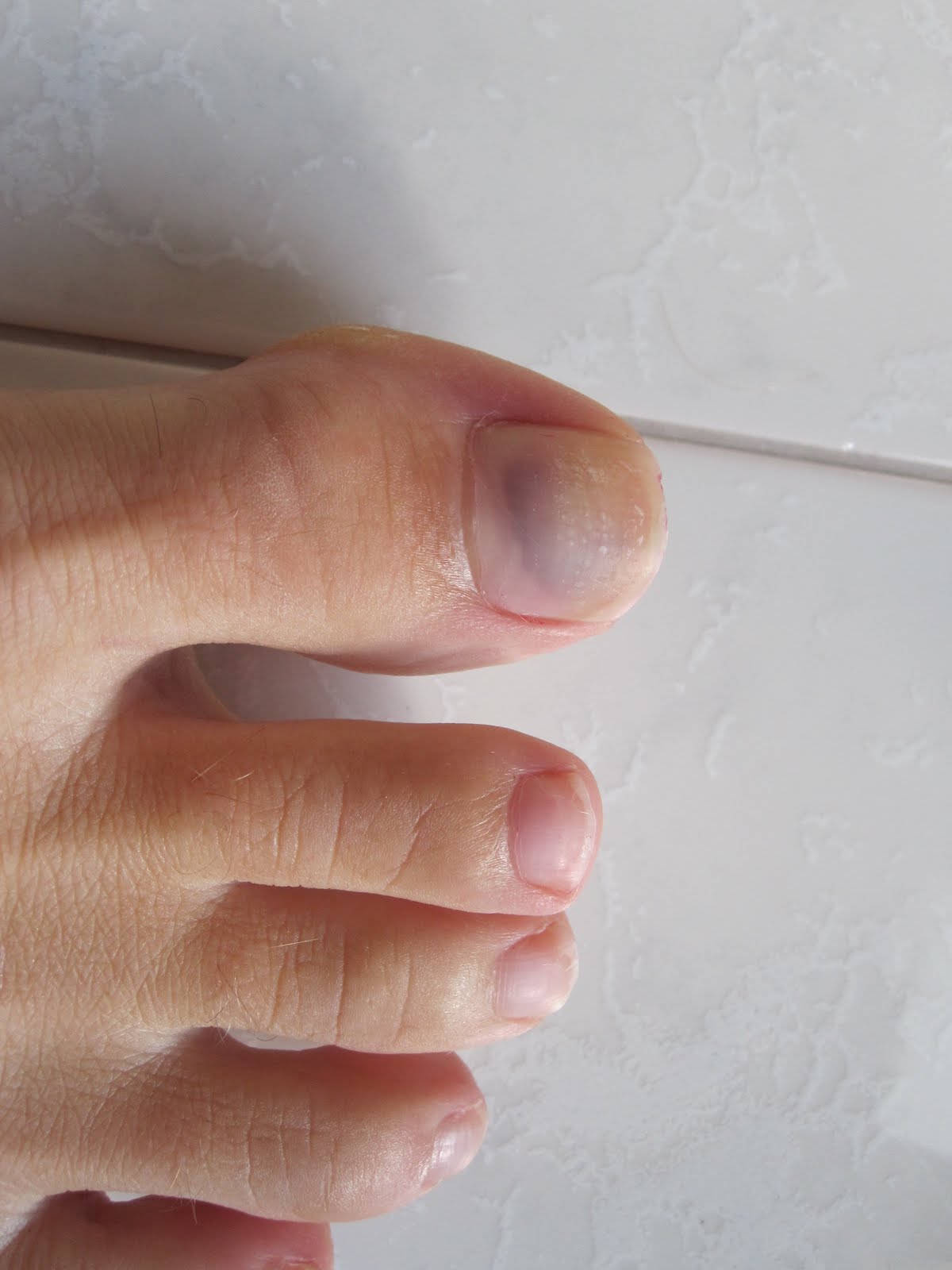 The Unexpected Runner I officially have gross running feet....& a