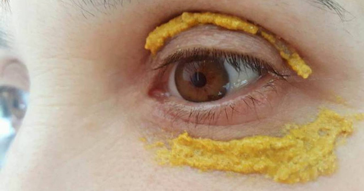 Tips Healthy SHE STARTED APPLYING TURMERIC AROUND HER EYES. 10 MINUTES