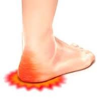 what causes heel pain