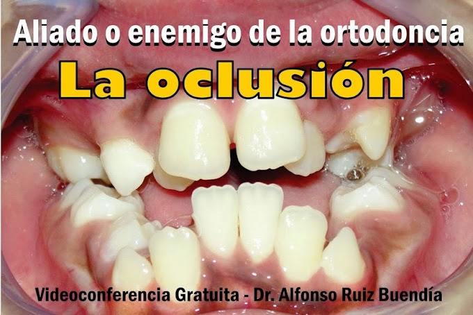 ORTODONCIA: La Oclusión, ¿aliado o enemigo? - Dr. Alfonso Ruiz Buendía
