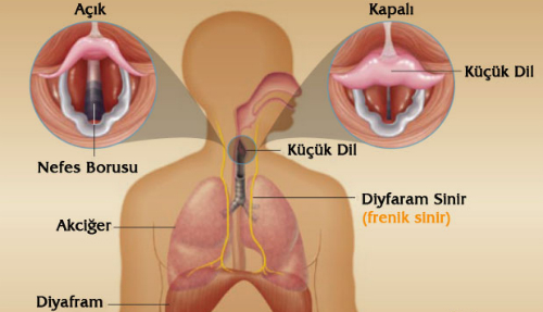 hickirik nedir nasil olusur