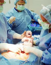 Caesarean Malpresentation of fetus Tips | Medical Help, Health Tips