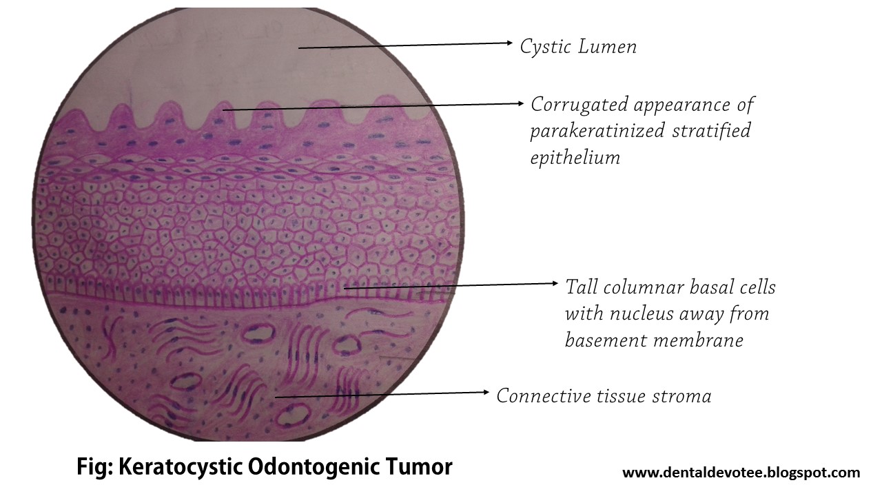 Dentosphere World of Dentistry Oral Pathology Histopathological