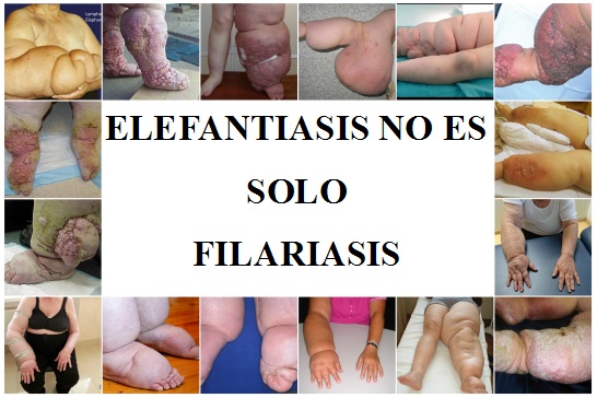 Las piernas se cansan corriendo