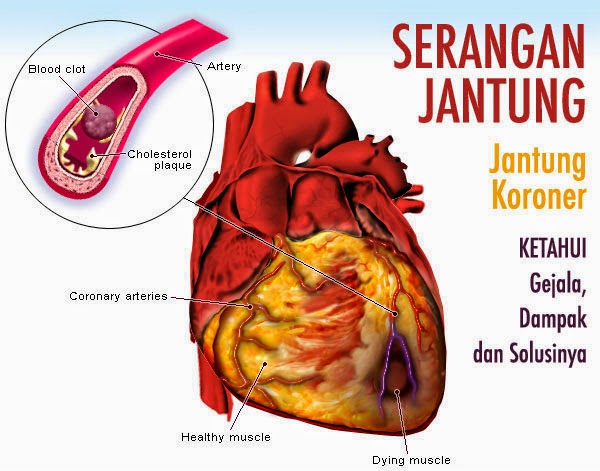 Gambar jantung