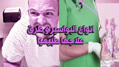 انواع البواسير و طرق علاجها طبيعيا