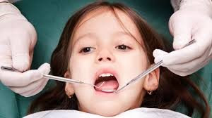Điều trị răng mọc lệch cho bé như thế nào?