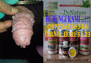Obat Kutil Kelamin,Obat Kutil Kelamin Tradisional,Obat Kutil Kelamin Di Apotik,Obat Tradisional Kutil Kelamin,Obat Herbal Kutil Kelamin,Obat Kutil Kelamin Pria,Obat Alami Kutil Kelamin,Obat Kutil Kelamin Wanita,Obat Untuk Kutil Kelamin,Obat Kutil Kelamin Alami,Obat Kutil Kelamin Herbal,Jual Obat Kutil Kelamin,Obat Kutil Kelamin Ampuh,Obat Kutil Di Kelamin,Obat Kutil Kelamin Murah,Obat Salep Kutil Kelamin,Obat Kutil Kelamin Tanpa Operasi,Obat Penghilang Kutil Kelamin,Nama Obat Kutil Kelamin,Obat Tradisional Untuk Kutil Kelamin,Obat Herbal Untuk Kutil Kelamin,Obat Penyakit Kutil Kelamin,Obat Perontok Kutil Kelamin,Obat Kutil Pada Kelamin,Obat Kutil Kelamin Paling Ampuh,Obat Kutil Kelamin Manjur,Obat Kutil Kelamin De Nature,Obat Alami Untuk Kutil Kelamin,Obat Tradisional Kutil Kelamin Pria,Nama Obat Kutil Kelamin Di Apotik,Obat Kutil Kelamin Pada Pria,Obat Kutil Kelamin Pada Wanita,Obat Kutil Kelamin Apotik,Harga Obat Kutil Kelamin,Callusol Obat Kutil Kelamin,De Nature Obat Kutil Kelamin,Kutil Di Kemaluan,Kutil Di Kemaluan Cowok,Kutil Di Kemaluan Lelaki,Kencing Nanah Pada Wanita,Obat Penyakit Gonore,Obat Kencing Nanah Pada Pria Di Apotik,Obat Kutil Di Kemaluan Pria,Bahaya Kutil Di Kemaluan,Kutil Di Sekitar Kemaluan,Gejala Kutil Di Kemaluan,Gambar Kutil Di Kemaluan Wanita,Menghilangkan Kutil Di Kemaluan,Pengobatan Kencing Nanah Dengan Antibiotik,Contoh Kutil Di Kemaluan,Kutil Di Bibir Kemaluan Wanita,Gambar Kutil Di Kemaluan,Obat Kutil Alat Kelamin,Obat Kutil Kelamin Di Apotik Kimia Farma,Bahaya Kutil Di Kemaluan Pria,Kutil Di Alat Kemaluan,Kutil Di Alat Kelamin Wanita,Kutil Di Area Kelamin,Obat Kutil Kemaluan Di Apotik,Kutil Kelamin Apakah Berbahaya,Kutil Kelamin Apa Bisa Sembuh,Kutil Kelamin Atau Jengger Ayam,Kutil Kelamin Awal,Kutil Kelamin Albothyl,Kutil Kelamin Apa Bisa Sembuh Total,Kutil Kelamin Apakah Gatal,Kutil Kelamin Apakah Menular,Kutil Kelamin Apakah Bisa Disembuhkan,Kutil Kelamin Apakah Bisa Sembuh Total,Kutil Di Batang Kemaluan,Kutil Di Bagian Kemaluan,Kutil Di Biji Kemaluan,Apakah Kutil Di Kemaluan Berbahaya,Kutil Kelamin Di Buah Zakar,Kutil Kelamin Di Bibir,Kutil Di Bagian Kelamin,Obat Kutil Di Batang Kemaluan,Apakah Kutil Di Kelamin Berbahaya,Apakah Kutil Di Kelamin Bisa Sembuh,Kutil Kelamin Bisa Sembuh Sendiri,Kutil Kelamin Bisa Sembuh,Kutil Kelamin Bisa Disembuhkan,Kutil Kelamin Berbahaya,Kutil Kelamin Bisa Hilang Sendiri,Kutil Kelamin Berdarah,Kutil Kelamin Condyloma Acuminata,Kutil Kelamin Cara Menyembuhkan,Kutil Kelamin.Com,Kutil Kelamin Cuka,Kutil Kelamin Cuka Apel,Kutil Kelamin Ciri Cirinya,Cara Mengobati Kutil Di Kemaluan Pria,Cara Menghilangkan Kutil Di Kemaluan Pria,Cara Mengobati Kutil Di Kemaluan Wanita,Cara Menghilangkan Kutil Di Kemaluan Wanita,Cara Menyembuhkan Kutil Di Kemaluan,Cara Mengobati Kutil Di Kemaluan Secara Alami,Cara Menghilangkan Kutil Di Kemaluan Pria Secara Alami,Cara Menghilangkan Kutil Di Kemaluan Secara Alami,Cara Membuang Kutil Di Kemaluan,Cara Mengobati Kutil Di Kemaluan Pria Secara Alami,Kutil Di Daerah Kemaluan,Kutil Di Dekat Kemaluan,Kutil Kelamin Di Dubur,Kutil Di Daerah Kelamin,Kutil Di Dekat Kelamin,Kutil Disekitar Kemaluan,Kutil Dekat Kemaluan,Kutil Kelamin Dan Pengobatannya,Kutil Kelamin Dapat Disembuhkan,Kutil Kelamin Disebabkan Oleh,Kutil Kelamin Dan Obatnya,Kutil Kelamin De Nature,Kutil Kelamin Disebabkan,Kutil Kelamin Dan Hiv,Kutil Kelamin Dapat Sembuh,Kutil Kelamin Dengan Propolis,Kutil Kelamin Disebabkan Oleh Apa,Kutil Kelamin Dapat Hilang Sendiri,Kutil Kelamin Dibakar,Kutil Kelamin Forum,Foto Kutil Di Kemaluan,Kutil Kelamin Gatal,Kutil Kelamin Gambar,Kutil Kelamin Gejala,Kutil Kelamin Gejala Awal,Kutil Kelamin Hilang Sendiri,Kutil Kelamin Hpv,Kutil Kelamin Hiv,Kutil Kelamin Hamil,Kutil Kelamin Hilang Dengan Sendirinya,Kutil Kelamin Hitam,Kutil Kelamin Herbal,Kutil Kelamin Herpes,Tumbuh Kutil Di Kemaluan Saat Hamil,Kutil Kelamin Jengger Ayam,Kutil Kelamin Jinak,Jenis Kutil Di Kemaluan,Kutil Di Kulit Kelamin,Kutil Kelamin Kaskus,Kutil Kelamin Kecil,Kutil Kelamin Kambuh Lagi,Kutil Kelamin Kapur Sirih,Kutil Kecil Di Kemaluan,Kumpulan Obat Kutil Di Kemaluan,Kutil Di Kemaluan Laki Laki,Kutil Di Kelamin Laki2,Kutil Di Kelamin Laki Laki,Kutil Di Kelamin Lelaki,Kutil Kelamin Di Lidah,Kutil Kelamin Di Laser,Kutil Pada Kemaluan Lelaki,Kutil Di Alat Kelamin Lelaki,Obat Kutil Di Kelamin Laki Laki,Kutil Kelamin Laki Laki,Kutil Kelamin Lelaki,Kutil Kelamin Laki2,Kutil Kelamin Laser,Kutil Kelamin Di Mulut,Kutil Kelamin Di Miss V,Kutil Kelamin Menular,Kutil Kelamin Membesar,Kutil Kelamin Menurut Dokter,Kutil Kelamin Menularkah,Kutil Kelamin Menular Melalui,Kutil Kelamin Muncul Lagi,Kutil Kelamin Menular Atau Tidak,Kutil Kelamin Mengering,Kutil Kelamin Mematikan,Kutil Kelamin Menyebabkan Kemandulan,Kutil Kelamin Menyebar,Kutil Kelamin Mengecil,Kutil Kelamin Menyebabkan Kematian,Mengobati Kutil Di Kemaluan,Mengatasi Kutil Di Kemaluan,Mengobati Kutil Di Kemaluan Secara Alami,Kutil Kelamin Normal,Kutil Kelamin Obat,Kutil Kelamin Obat Tradisional,Kutil Kelamin Obat Herbal,Kutil Kelamin Obatnya,Kutil Kelamin Operasi,Kutil Kelamin Obatnya Apa,Obat Untuk Kutil Di Kemaluan,Obat Penghilang Kutil Di Kemaluan,Obat Alami Kutil Di Kemaluan Pria,Obat Tradisional Kutil Di Kemaluan Pria,Kutil Di Kemaluan Pria,Kutil Di Pangkal Kemaluan,Kutil Di Kelamin Perempuan,Gambar Kutil Di Kemaluan Pria,Kutil Kemaluan Pria,Kutil Di Pangkal Kelamin,Kutil Kelamin Di Paha,Kutil Pada Kemaluan,Gambar Kutil Di Kelamin Pria,Kutil Di Sekitar Kelamin Pria,Kutil Kelamin Pada Pria,Kutil Di Rambut Kemaluan,Kutil Di Sekitar Rambut Kemaluan,Kutil Kelamin Ringan,Kutil Kelamin Rontok,Kutil Di Sekitar Kemaluan Wanita,Kutil Di Sekitar Kelamin,Kutil Kelamin Di Sebabkan Oleh,Kutil Di Sekitar Kelamin Wanita,Tumbuh Kutil Di Sekitar Kemaluan,Obat Kutil Di Sekitar Kemaluan,Kutil Sekitar Kemaluan,Kutil Kelamin Sembuh,Kutil Kelamin Sembuh Sendiri,Kutil Kelamin Saat Hamil,Kutil Kelamin Seperti Apa,Kutil Kelamin Stadium Awal,Kutil Kelamin Di Tenggorokan,Kutil Kelamin Tumbuh Lagi,Kutil Kelamin Tidak Berbahaya,Kutil Kelamin Tidak Gatal,Kutil Kelamin Tahap Awal,Kutil Kelamin Tidak Bisa Sembuh,Kutil Kelamin Tidak Bahaya,Kutil Kelamin Terasa Gatal,Kutil Kelamin Termasuk Hiv,Kutil Kelamin Tanda Hiv,Tumbuh Kutil Di Kemaluan,Tanda Kutil Di Kemaluan,Obat Tradisional Kutil Di Kemaluan,Penyebab Tumbuh Kutil Di Kemaluan,Kutil Di Ujung Kelamin,Obat Untuk Menghilangkan Kutil Di Kemaluan,Kutil Di Kemaluan Wanita,Kutil Di Kelamin Wanita,Penyebab Kutil Di Kemaluan Wanita,Obat Kutil Di Kemaluan Wanita,Bahaya Kutil Di Kemaluan Wanita,Penyakit Kutil Di Kemaluan Wanita,Gambar Kutil Di Kelamin Wanita,Penyakit Kutil Di Kelamin Wanita,Obat Kutil Di Kelamin Wanita,Kutil Kelamin Wanita,Kutil Kelamin Wikipedia,Kutil Kelamin Warna Hitam,Kutil Kelamin Wanita Hamil,Kutil Kelamin Yang Tidak Berbahaya,Kutil Kelamin Yang Baru Tumbuh,Kutil Kelamin Yang Masih Kecil,Kutil Kelamin Yang Berbahaya,Kutil Kelamin Yang Sudah Sembuh,Obat Kutil Kemaluan,Obat Kutil Kemaluan Alami,Obat Kutil Kemaluan Pria,Obat Kutil Kelamin Yang Dijual Di Apotik,Obat Kutil Kelamin Resep Dokter,Obat Kutil Kelamin Yang Ada Di Apotik,Obat Kutil Kelamin Ibu Hamil,Obat Kutil Kelamin Ace Maxs,Obat Kutil Kelamin Ace Max,Obat Kutil Kelamin Apa,Obat Kutil Kelamin Aldara,Obat Kutil Kelamin Asli,Obat Kutil Kelamin Atau Jengger Ayam,Obat Kutil Kelamin Yg Ada Di Apotik,Obat Kutil Kelamin Yg Ampuh,Obat Kutil Kelamin Bandung,Obat Kutil Kelamin Bawang Putih,Obat Kutil Kelamin Buat Sendiri,Obat Kutil Kelamin Di Bandung,Obat Kutil Kelamin Yang Bagus,Obat Kutil Kelamin Di Bali,Obat Kutil Kelamin Yang Bisa Dibeli Di Apotik,Obat Kutil Kelamin Callusol,Obat Kutil Kelamin Cina,Obat Kutil Kelamin China,Www.Obat Kutil Kelamin.Com,Obat Kutil Kelamin Dengan Cuka,Cara Obat Kutil Pada Kemaluan,Obat Kutil Di Kemaluan,Obat Kutil Kelamin Dokter,Obat Kutil Kelamin Dari Dokter,Obat Kutil Kelamin Di Jakarta,Obat Kutil Kelamin Di Kimia Farma,Obat Kutil Kelamin Dari Tumbuhan,Obat Kutil Kelamin Dari Dalam,Obat Kutil Kelamin De Nature Indonesia,Obat Kutil Kelamin Di Surabaya,Obat Kutil Kelamin Di Medan,Obat Kutil Kelamin Di Apotik Umum,Obat Kutil Kelamin Di Malaysia,Obat Kutil Kelamin Di Yogyakarta,Obat Kutil Kelamin Kimia Farma,Obat Kutil Kelamin Generik,Obat Kutil Kelamin Hpv,Obat Kutil Kelamin Secara Herbal,Obat Herbal Kutil Kemaluan Pria,Obat Kutil Kelamin Pada Ibu Hamil,Obat Kutil Kelamin Jakarta,Obat Kutil Kelamin Jogja,Obat Kutil Kelamin/Jengger Ayam,Obat Kondiloma Kutil Kelamin Jengger Ayam,Obat Kutil Kelamin Di Jogja,Obat Kutil Kelamin Murah Jombang,Obat Kutil Kelamin Kaskus,Obat Kutil Kelamin Kapur Sirih,Obat Kutil Kelamin Kimia,Obat Kutil Kelamin K Link,Obat Kutil Kelamin Di K24,Kumpulan Obat Kutil Pada Kemaluan,Obat Kutil Kelamin Laki Laki,Obat Kutil Kelamin Laki2,Obat Tradisional Kutil Kelamin Laki Laki,Obat Kutil Kelamin Malaysia,Obat Kutil Kelamin Mujarab,Obat Kutil Kelamin Medis,Obat Kutil Kelamin Menurut Dokter,Obat Kutil Kelamin Yang Murah,Obat Kutil Kelamin Paling Murah,Obat Kutil Kelamin Secara Medis,Obat Kutil Kelamin Paling Manjur,Obat Kutil Kelamin Paling Mujarab,Obat Kutil Kelamin Yang Manjur,Jual Obat Kutil Kelamin Murah,Obat Kutil Kelamin Oles,Obat Kutil Kelamin Online,Obat Kutil Kemaluan Pria Di Apotik,Obat Kutil Pada Kemaluan,Obat Kutil Pada Kemaluan Pria,Obat Kutil Pada Kemaluan Wanita,Obat Kutil Kelamin Pada Wanita Hamil,Obat Kutil Kelamin Propolis,Obat Kutil Kelamin Perempuan,Obat Kutil Kelamin Pria Dan Wanita,Obat Kutil Di Kelamin Pria,Obat Kutil Kelamin Rumahan,Obat Kutil Kelamin Rontok,Obat Kutil Kelamin Rekomendasi Dokter,Obat Kutil Kelamin Secara Alami,Obat Kutil Kelamin Salep,Obat Kutil Kelamin Surabaya,Obat Kutil Kelamin Swiss Paris,Obat Kutil Kelamin Sinshe,Obat Kutil Kelamin Di Semarang,Jual Obat Kutil Kelamin Surabaya,Obat Kutil Kelamin Di Solo,Obat Kutil Kemaluan Tradisional,Obat Kutil Kelamin Tricajus,Obat Kutil Kelamin Terbaik,Obat Kutil Kelamin Termurah,Obat Kutil Kelamin Tiens,Obat Kutil Kelamin Tianshi,Artikel Obat Kutil Kelamin Tradisional,Obat Kutil Kelamin Yang Tersedia Di Apotik,Obat Kutil Kelamin Yang Tersedia Di Apotek,Obat Kutil Kelamin Untuk Ibu Hamil,Obat Kutil Kelamin Untuk Wanita,Obat Kutil Kelamin Untuk Wanita Hamil,Obat Kutil Untuk Kelamin,Obat Kutil Kemaluan Wanita Di Apotik,Obat Kutil Kelamin Wartrol,Obat Tradisional Kutil Kelamin Wanita,Obat Alami Kutil Kelamin Wanita,Obat Herbal Kutil Kelamin Wanita,Obat Kutil Kelamin Yang Ampuh,Obat Kutil Kelamin Yg Dijual Di Apotik,Obat Kutil Kelamin Yang Alami,Obat Kutil Kelamin Yang Dijual Di Apotek,Obat Kutil Kelamin Yahoo,Obat Kutil Kelamin Yang Aman,Obat Kutil Kelamin Yg Paling Ampuh,Nama Obat Kutil Kelamin Yang Dijual Di Apotik,Obat Alami Kutil Di Kemaluan,Obat Kutil Kelamin Di Apotik K24,Obat Kutil Kelamin Di Apotik Terdekat,Obat Kutil Kelamin Di Apotik Century,Beli Obat Kutil Kelamin Di Apotik,Obat Herbal Kutil Kelamin Di Apotik,Obat Penghilang Kutil Kelamin Di Apotik,Salep Obat Kutil Kelamin Di Apotik,Merk Obat Kutil Kelamin Di Apotik,Apa Obat Kutil Kelamin Di Apotik,Jual Obat Kutil Kelamin Di Apotik,Obat Generik Kutil Kelamin Di Apotik,Harga Obat Kutil Kelamin Di Apotik,obat kutil kelamin pria alami,obat kutil kelamin ala dokter,obat kutil kelamin alodokter,obat kutil kelamin bukalapak,obat buat kutil kelamin,obat bisul kutil kelamin,beli obat kutil kelamin,toko obat kutil kelamin di bandung,obat tradisional buat kutil kelamin,obat salep buat kutil kelamin,obat alami buat kutil kelamin,dimana beli obat kutil kelamin,berapa harga obat kutil kelamin,bahan alami obat kutil kelamin,lidah buaya obat kutil kelamin,cara obat kutil kelamin tradisional,cuka obat kutil kelamin,cream obat kutil kelamin,cari obat kutil kelamin,obat cina untuk kutil kelamin,obat china untuk kutil kelamin,obat callusol untuk kutil kelamin,cara membuat obat kutil kelamin,obat cina penghilang kutil kelamin,cara pemakaian obat kutil kelamin de nature,cara pakai obat kutil kelamin,cara pemakaian obat kutil kelamin,cuka apel untuk obat kutil kelamin,cuka sari apel obat kutil kelamin,obat kutil kelamin dengan bawang putih,obat kutil kelamin dijual di apotik,obat kutil kelamin di dubur,obat farmasi kutil kelamin,nama obat kutil kelamin di kimia farma,obat farmasi untuk kutil kelamin,garcia obat kutil kelamin,obat gatal kutil kelamin,jelly gamat obat kutil kelamin,obat kutil kelamin herbal terbukti keampuhannya,harga obat kutil kelamin de nature,obat herbal penyakit kutil kelamin,obat herbal penghilang kutil kelamin,daftar harga obat kutil kelamin,tanaman herbal obat kutil kelamin,obat herbal penyembuh kutil kelamin,obat ampuh hilangkan kutil kelamin,kutil kelamin info obat,obat kutil kelamin yang di jual di apotek,jenis obat kutil kelamin,jual obat kutil kelamin ampuh,apotik jual obat kutil kelamin,obat jamur kutil kelamin,obat kutil di kulit kelamin,obat krim kutil kelamin,kapsul obat kutil kelamin,kalpanax obat kutil kelamin,obat kampung kutil kelamin,obat kimia untuk kutil kelamin,kulit manggis obat kutil kelamin,kulit pisang obat kutil kelamin,obat kampung untuk kutil kelamin,obat menghilangkan kutil kelamin,obat minum kutil kelamin,nama obat kutil kelamin pria,nama salep obat kutil kelamin,d nature obat kutil kelamin,apa nama obat kutil kelamin,kutil kelamin dan obat nya,nama obat untuk kutil kelamin,nama obat penyakit kutil kelamin,nama obat kutil di kelamin,obat oral kutil kelamin,obat oles untuk kutil kelamin,obat penyakit kutil kelamin pria,obat untuk kutil kelamin pria,obat herbal kutil kelamin pria,ramuan obat kutil kelamin,resep obat kutil kelamin,ramuan tradisional obat kutil kelamin,obat rumahan untuk kutil kelamin,obat resep dokter untuk kutil kelamin,resep obat tradisional kutil kelamin,cara membuat ramuan obat kutil kelamin,obat kutil di sekitar kelamin,obat sakit kutil kelamin,obat suntik kutil kelamin,obat salep untuk kutil kelamin,obat kutil kelamin tradisional paling ampuh,tumbuhan obat kutil kelamin,obat tradisional kutil kelamin pada pria,obat tetes kutil kelamin,toko obat kutil kelamin,obat topikal kutil kelamin,obat untuk kutil kelamin pada pria,obat utk kutil kelamin,obat dokter untuk kutil kelamin,obat untuk penyakit kutil kelamin,obat apotik untuk kutil kelamin,obat medis untuk kutil kelamin,obat untuk menghilangkan kutil kelamin,obat generik untuk kutil kelamin,obat antibiotik untuk kutil kelamin,obat alami kutil kelamin pada wanita,obat tradisional kutil kelamin pada wanita,xamthone obat kutil kelamin,apotik yang menjual obat kutil kelamin,penyakit obat kutil kelamin tradisional,obat tradisional menyembuhkan kutil kelamin,obat tradisional menghilangkan kutil kelamin,obat tradisional utk kutil kelamin,obat tradisional untuk kutil kelamin pria,obat tradisional penyembuh kutil kelamin,mengobati kutil kelamin dengan obat tradisional,obat tradisional untuk menyembuhkan kutil kelamin,obat tradisional untuk penyakit kutil kelamin,obat tradisional untuk mengobati kutil kelamin,obat tradisional kutil di kelamin,obat tradisional menghilangkan kutil di kelamin,obat tradisional untuk kutil di kelamin,menghilangkan kutil kelamin dengan obat tradisional,obat tradisional mengobati kutil kelamin,obat kutil kelamin tradisional paling mujarab,obat tradisional penghilang kutil kelamin,obat tradisional untuk kutil pada kelamin,obat kutil kelamin secara tradisional,ramuan tradisional kutil kelamin,obat alami kutil kelamin pria,obat tradisional penyakit kutil kelamin,obat alami kutil di kelamin pria,obat alami menghilangkan kutil di kelamin,obat alami untuk kutil di kelamin,cara mengobati kutil kelamin dengan obat tradisional,obat alami kutil pada kelamin,obat herbal untuk kutil pada kelamin Obat Kutil Kelamin,Obat Kutil Kelamin Tradisional,Obat Kutil Kelamin Di Apotik,Obat Tradisional Kutil Kelamin,Obat Herbal Kutil Kelamin,Obat Kutil Kelamin Pria,Obat Alami Kutil Kelamin,Obat Kutil Kelamin Wanita,Obat Untuk Kutil Kelamin,Obat Kutil Kelamin Alami,Obat Kutil Kelamin Herbal,Jual Obat Kutil Kelamin,Obat Kutil Kelamin Ampuh,Obat Kutil Di Kelamin,Obat Kutil Kelamin Murah,Obat Salep Kutil Kelamin,Obat Kutil Kelamin Tanpa Operasi,Obat Penghilang Kutil Kelamin,Nama Obat Kutil Kelamin,Obat Tradisional Untuk Kutil Kelamin,Obat Herbal Untuk Kutil Kelamin,Obat Penyakit Kutil Kelamin,Obat Perontok Kutil Kelamin,Obat Kutil Pada Kelamin,Obat Kutil Kelamin Paling Ampuh,Obat Kutil Kelamin Manjur,Obat Kutil Kelamin De Nature,Obat Alami Untuk Kutil Kelamin,Obat Tradisional Kutil Kelamin Pria,Nama Obat Kutil Kelamin Di Apotik,Obat Kutil Kelamin Pada Pria,Obat Kutil Kelamin Pada Wanita,Obat Kutil Kelamin Apotik,Harga Obat Kutil Kelamin,Callusol Obat Kutil Kelamin,De Nature Obat Kutil Kelamin,Kutil Di Kemaluan,Kutil Di Kemaluan Cowok,Kutil Di Kemaluan Lelaki,Kencing Nanah Pada Wanita,Obat Penyakit Gonore,Obat Kencing Nanah Pada Pria Di Apotik,Obat Kutil Di Kemaluan Pria,Bahaya Kutil Di Kemaluan,Kutil Di Sekitar Kemaluan,Gejala Kutil Di Kemaluan,Gambar Kutil Di Kemaluan Wanita,Menghilangkan Kutil Di Kemaluan,Pengobatan Kencing Nanah Dengan Antibiotik,Contoh Kutil Di Kemaluan,Kutil Di Bibir Kemaluan Wanita,Gambar Kutil Di Kemaluan,Obat Kutil Alat Kelamin,Obat Kutil Kelamin Di Apotik Kimia Farma,Bahaya Kutil Di Kemaluan Pria,Kutil Di Alat Kemaluan,Kutil Di Alat Kelamin Wanita,Kutil Di Area Kelamin,Obat Kutil Kemaluan Di Apotik,Kutil Kelamin Apakah Berbahaya,Kutil Kelamin Apa Bisa Sembuh,Kutil Kelamin Atau Jengger Ayam,Kutil Kelamin Awal,Kutil Kelamin Albothyl,Kutil Kelamin Apa Bisa Sembuh Total,Kutil Kelamin Apakah Gatal,Kutil Kelamin Apakah Menular,Kutil Kelamin Apakah Bisa Disembuhkan,Kutil Kelamin Apakah Bisa Sembuh Total,Kutil Di Batang Kemaluan,Kutil Di Bagian Kemaluan,Kutil Di Biji Kemaluan,Apakah Kutil Di Kemaluan Berbahaya,Kutil Kelamin Di Buah Zakar,Kutil Kelamin Di Bibir,Kutil Di Bagian Kelamin,Obat Kutil Di Batang Kemaluan,Apakah Kutil Di Kelamin Berbahaya,Apakah Kutil Di Kelamin Bisa Sembuh,Kutil Kelamin Bisa Sembuh Sendiri,Kutil Kelamin Bisa Sembuh,Kutil Kelamin Bisa Disembuhkan,Kutil Kelamin Berbahaya,Kutil Kelamin Bisa Hilang Sendiri,Kutil Kelamin Berdarah,Kutil Kelamin Condyloma Acuminata,Kutil Kelamin Cara Menyembuhkan,Kutil Kelamin.Com,Kutil Kelamin Cuka,Kutil Kelamin Cuka Apel,Kutil Kelamin Ciri Cirinya,Cara Mengobati Kutil Di Kemaluan Pria,Cara Menghilangkan Kutil Di Kemaluan Pria,Cara Mengobati Kutil Di Kemaluan Wanita,Cara Menghilangkan Kutil Di Kemaluan Wanita,Cara Menyembuhkan Kutil Di Kemaluan,Cara Mengobati Kutil Di Kemaluan Secara Alami,Cara Menghilangkan Kutil Di Kemaluan Pria Secara Alami,Cara Menghilangkan Kutil Di Kemaluan Secara Alami,Cara Membuang Kutil Di Kemaluan,Cara Mengobati Kutil Di Kemaluan Pria Secara Alami,Kutil Di Daerah Kemaluan,Kutil Di Dekat Kemaluan,Kutil Kelamin Di Dubur,Kutil Di Daerah Kelamin,Kutil Di Dekat Kelamin,Kutil Disekitar Kemaluan,Kutil Dekat Kemaluan,Kutil Kelamin Dan Pengobatannya,Kutil Kelamin Dapat Disembuhkan,Kutil Kelamin Disebabkan Oleh,Kutil Kelamin Dan Obatnya,Kutil Kelamin De Nature,Kutil Kelamin Disebabkan,Kutil Kelamin Dan Hiv,Kutil Kelamin Dapat Sembuh,Kutil Kelamin Dengan Propolis,Kutil Kelamin Disebabkan Oleh Apa,Kutil Kelamin Dapat Hilang Sendiri,Kutil Kelamin Dibakar,Kutil Kelamin Forum,Foto Kutil Di Kemaluan,Kutil Kelamin Gatal,Kutil Kelamin Gambar,Kutil Kelamin Gejala,Kutil Kelamin Gejala Awal,Kutil Kelamin Hilang Sendiri,Kutil Kelamin Hpv,Kutil Kelamin Hiv,Kutil Kelamin Hamil,Kutil Kelamin Hilang Dengan Sendirinya,Kutil Kelamin Hitam,Kutil Kelamin Herbal,Kutil Kelamin Herpes,Tumbuh Kutil Di Kemaluan Saat Hamil,Kutil Kelamin Jengger Ayam,Kutil Kelamin Jinak,Jenis Kutil Di Kemaluan,Kutil Di Kulit Kelamin,Kutil Kelamin Kaskus,Kutil Kelamin Kecil,Kutil Kelamin Kambuh Lagi,Kutil Kelamin Kapur Sirih,Kutil Kecil Di Kemaluan,Kumpulan Obat Kutil Di Kemaluan,Kutil Di Kemaluan Laki Laki,Kutil Di Kelamin Laki2,Kutil Di Kelamin Laki Laki,Kutil Di Kelamin Lelaki,Kutil Kelamin Di Lidah,Kutil Kelamin Di Laser,Kutil Pada Kemaluan Lelaki,Kutil Di Alat Kelamin Lelaki,Obat Kutil Di Kelamin Laki Laki,Kutil Kelamin Laki Laki,Kutil Kelamin Lelaki,Kutil Kelamin Laki2,Kutil Kelamin Laser,Kutil Kelamin Di Mulut,Kutil Kelamin Di Miss V,Kutil Kelamin Menular,Kutil Kelamin Membesar,Kutil Kelamin Menurut Dokter,Kutil Kelamin Menularkah,Kutil Kelamin Menular Melalui,Kutil Kelamin Muncul Lagi,Kutil Kelamin Menular Atau Tidak,Kutil Kelamin Mengering,Kutil Kelamin Mematikan,Kutil Kelamin Menyebabkan Kemandulan,Kutil Kelamin Menyebar,Kutil Kelamin Mengecil,Kutil Kelamin Menyebabkan Kematian,Mengobati Kutil Di Kemaluan,Mengatasi Kutil Di Kemaluan,Mengobati Kutil Di Kemaluan Secara Alami,Kutil Kelamin Normal,Kutil Kelamin Obat,Kutil Kelamin Obat Tradisional,Kutil Kelamin Obat Herbal,Kutil Kelamin Obatnya,Kutil Kelamin Operasi,Kutil Kelamin Obatnya Apa,Obat Untuk Kutil Di Kemaluan,Obat Penghilang Kutil Di Kemaluan,Obat Alami Kutil Di Kemaluan Pria,Obat Tradisional Kutil Di Kemaluan Pria,Kutil Di Kemaluan Pria,Kutil Di Pangkal Kemaluan,Kutil Di Kelamin Perempuan,Gambar Kutil Di Kemaluan Pria,Kutil Kemaluan Pria,Kutil Di Pangkal Kelamin,Kutil Kelamin Di Paha,Kutil Pada Kemaluan,Gambar Kutil Di Kelamin Pria,Kutil Di Sekitar Kelamin Pria,Kutil Kelamin Pada Pria,Kutil Di Rambut Kemaluan,Kutil Di Sekitar Rambut Kemaluan,Kutil Kelamin Ringan,Kutil Kelamin Rontok,Kutil Di Sekitar Kemaluan Wanita,Kutil Di Sekitar Kelamin,Kutil Kelamin Di Sebabkan Oleh,Kutil Di Sekitar Kelamin Wanita,Tumbuh Kutil Di Sekitar Kemaluan,Obat Kutil Di Sekitar Kemaluan,Kutil Sekitar Kemaluan,Kutil Kelamin Sembuh,Kutil Kelamin Sembuh Sendiri,Kutil Kelamin Saat Hamil,Kutil Kelamin Seperti Apa,Kutil Kelamin Stadium Awal,Kutil Kelamin Di Tenggorokan,Kutil Kelamin Tumbuh Lagi,Kutil Kelamin Tidak Berbahaya,Kutil Kelamin Tidak Gatal,Kutil Kelamin Tahap Awal,Kutil Kelamin Tidak Bisa Sembuh,Kutil Kelamin Tidak Bahaya,Kutil Kelamin Terasa Gatal,Kutil Kelamin Termasuk Hiv,Kutil Kelamin Tanda Hiv,Tumbuh Kutil Di Kemaluan,Tanda Kutil Di Kemaluan,Obat Tradisional Kutil Di Kemaluan,Penyebab Tumbuh Kutil Di Kemaluan,Kutil Di Ujung Kelamin,Obat Untuk Menghilangkan Kutil Di Kemaluan,Kutil Di Kemaluan Wanita,Kutil Di Kelamin Wanita,Penyebab Kutil Di Kemaluan Wanita,Obat Kutil Di Kemaluan Wanita,Bahaya Kutil Di Kemaluan Wanita,Penyakit Kutil Di Kemaluan Wanita,Gambar Kutil Di Kelamin Wanita,Penyakit Kutil Di Kelamin Wanita,Obat Kutil Di Kelamin Wanita,Kutil Kelamin Wanita,Kutil Kelamin Wikipedia,Kutil Kelamin Warna Hitam,Kutil Kelamin Wanita Hamil,Kutil Kelamin Yang Tidak Berbahaya,Kutil Kelamin Yang Baru Tumbuh,Kutil Kelamin Yang Masih Kecil,Kutil Kelamin Yang Berbahaya,Kutil Kelamin Yang Sudah Sembuh,Obat Kutil Kemaluan,Obat Kutil Kemaluan Alami,Obat Kutil Kemaluan Pria,Obat Kutil Kelamin Yang Dijual Di Apotik,Obat Kutil Kelamin Resep Dokter,Obat Kutil Kelamin Yang Ada Di Apotik,Obat Kutil Kelamin Ibu Hamil,Obat Kutil Kelamin Ace Maxs,Obat Kutil Kelamin Ace Max,Obat Kutil Kelamin Apa,Obat Kutil Kelamin Aldara,Obat Kutil Kelamin Asli,Obat Kutil Kelamin Atau Jengger Ayam,Obat Kutil Kelamin Yg Ada Di Apotik,Obat Kutil Kelamin Yg Ampuh,Obat Kutil Kelamin Bandung,Obat Kutil Kelamin Bawang Putih,Obat Kutil Kelamin Buat Sendiri,Obat Kutil Kelamin Di Bandung,Obat Kutil Kelamin Yang Bagus,Obat Kutil Kelamin Di Bali,Obat Kutil Kelamin Yang Bisa Dibeli Di Apotik,Obat Kutil Kelamin Callusol,Obat Kutil Kelamin Cina,Obat Kutil Kelamin China,Www.Obat Kutil Kelamin.Com,Obat Kutil Kelamin Dengan Cuka,Cara Obat Kutil Pada Kemaluan,Obat Kutil Di Kemaluan,Obat Kutil Kelamin Dokter,Obat Kutil Kelamin Dari Dokter,Obat Kutil Kelamin Di Jakarta,Obat Kutil Kelamin Di Kimia Farma,Obat Kutil Kelamin Dari Tumbuhan,Obat Kutil Kelamin Dari Dalam,Obat Kutil Kelamin De Nature Indonesia,Obat Kutil Kelamin Di Surabaya,Obat Kutil Kelamin Di Medan,Obat Kutil Kelamin Di Apotik Umum,Obat Kutil Kelamin Di Malaysia,Obat Kutil Kelamin Di Yogyakarta,Obat Kutil Kelamin Kimia Farma,Obat Kutil Kelamin Generik,Obat Kutil Kelamin Hpv,Obat Kutil Kelamin Secara Herbal,Obat Herbal Kutil Kemaluan Pria,Obat Kutil Kelamin Pada Ibu Hamil,Obat Kutil Kelamin Jakarta,Obat Kutil Kelamin Jogja,Obat Kutil Kelamin/Jengger Ayam,Obat Kondiloma Kutil Kelamin Jengger Ayam,Obat Kutil Kelamin Di Jogja,Obat Kutil Kelamin Murah Jombang,Obat Kutil Kelamin Kaskus,Obat Kutil Kelamin Kapur Sirih,Obat Kutil Kelamin Kimia,Obat Kutil Kelamin K Link,Obat Kutil Kelamin Di K24,Kumpulan Obat Kutil Pada Kemaluan,Obat Kutil Kelamin Laki Laki,Obat Kutil Kelamin Laki2,Obat Tradisional Kutil Kelamin Laki Laki,Obat Kutil Kelamin Malaysia,Obat Kutil Kelamin Mujarab,Obat Kutil Kelamin Medis,Obat Kutil Kelamin Menurut Dokter,Obat Kutil Kelamin Yang Murah,Obat Kutil Kelamin Paling Murah,Obat Kutil Kelamin Secara Medis,Obat Kutil Kelamin Paling Manjur,Obat Kutil Kelamin Paling Mujarab,Obat Kutil Kelamin Yang Manjur,Jual Obat Kutil Kelamin Murah,Obat Kutil Kelamin Oles,Obat Kutil Kelamin Online,Obat Kutil Kemaluan Pria Di Apotik,Obat Kutil Pada Kemaluan,Obat Kutil Pada Kemaluan Pria,Obat Kutil Pada Kemaluan Wanita,Obat Kutil Kelamin Pada Wanita Hamil,Obat Kutil Kelamin Propolis,Obat Kutil Kelamin Perempuan,Obat Kutil Kelamin Pria Dan Wanita,Obat Kutil Di Kelamin Pria,Obat Kutil Kelamin Rumahan,Obat Kutil Kelamin Rontok,Obat Kutil Kelamin Rekomendasi Dokter,Obat Kutil Kelamin Secara Alami,Obat Kutil Kelamin Salep,Obat Kutil Kelamin Surabaya,Obat Kutil Kelamin Swiss Paris,Obat Kutil Kelamin Sinshe,Obat Kutil Kelamin Di Semarang,Jual Obat Kutil Kelamin Surabaya,Obat Kutil Kelamin Di Solo,Obat Kutil Kemaluan Tradisional,Obat Kutil Kelamin Tricajus,Obat Kutil Kelamin Terbaik,Obat Kutil Kelamin Termurah,Obat Kutil Kelamin Tiens,Obat Kutil Kelamin Tianshi,Artikel Obat Kutil Kelamin Tradisional,Obat Kutil Kelamin Yang Tersedia Di Apotik,Obat Kutil Kelamin Yang Tersedia Di Apotek,Obat Kutil Kelamin Untuk Ibu Hamil,Obat Kutil Kelamin Untuk Wanita,Obat Kutil Kelamin Untuk Wanita Hamil,Obat Kutil Untuk Kelamin,Obat Kutil Kemaluan Wanita Di Apotik,Obat Kutil Kelamin Wartrol,Obat Tradisional Kutil Kelamin Wanita,Obat Alami Kutil Kelamin Wanita,Obat Herbal Kutil Kelamin Wanita,Obat Kutil Kelamin Yang Ampuh,Obat Kutil Kelamin Yg Dijual Di Apotik,Obat Kutil Kelamin Yang Alami,Obat Kutil Kelamin Yang Dijual Di Apotek,Obat Kutil Kelamin Yahoo,Obat Kutil Kelamin Yang Aman,Obat Kutil Kelamin Yg Paling Ampuh,Nama Obat Kutil Kelamin Yang Dijual Di Apotik,Obat Alami Kutil Di Kemaluan,Obat Kutil Kelamin Di Apotik K24,Obat Kutil Kelamin Di Apotik Terdekat,Obat Kutil Kelamin Di Apotik Century,Beli Obat Kutil Kelamin Di Apotik,Obat Herbal Kutil Kelamin Di Apotik,Obat Penghilang Kutil Kelamin Di Apotik,Salep Obat Kutil Kelamin Di Apotik,Merk Obat Kutil Kelamin Di Apotik,Apa Obat Kutil Kelamin Di Apotik,Jual Obat Kutil Kelamin Di Apotik,Obat Generik Kutil Kelamin Di Apotik,Harga Obat Kutil Kelamin Di Apotik,obat kutil kelamin pria alami,obat kutil kelamin ala dokter,obat kutil kelamin alodokter,obat kutil kelamin bukalapak,obat buat kutil kelamin,obat bisul kutil kelamin,beli obat kutil kelamin,toko obat kutil kelamin di bandung,obat tradisional buat kutil kelamin,obat salep buat kutil kelamin,obat alami buat kutil kelamin,dimana beli obat kutil kelamin,berapa harga obat kutil kelamin,bahan alami obat kutil kelamin,lidah buaya obat kutil kelamin,cara obat kutil kelamin tradisional,cuka obat kutil kelamin,cream obat kutil kelamin,cari obat kutil kelamin,obat cina untuk kutil kelamin,obat china untuk kutil kelamin,obat callusol untuk kutil kelamin,cara membuat obat kutil kelamin,obat cina penghilang kutil kelamin,cara pemakaian obat kutil kelamin de nature,cara pakai obat kutil kelamin,cara pemakaian obat kutil kelamin,cuka apel untuk obat kutil kelamin,cuka sari apel obat kutil kelamin,obat kutil kelamin dengan bawang putih,obat kutil kelamin dijual di apotik,obat kutil kelamin di dubur,obat farmasi kutil kelamin,nama obat kutil kelamin di kimia farma,obat farmasi untuk kutil kelamin,garcia obat kutil kelamin,obat gatal kutil kelamin,jelly gamat obat kutil kelamin,obat kutil kelamin herbal terbukti keampuhannya,harga obat kutil kelamin de nature,obat herbal penyakit kutil kelamin,obat herbal penghilang kutil kelamin,daftar harga obat kutil kelamin,tanaman herbal obat kutil kelamin,obat herbal penyembuh kutil kelamin,obat ampuh hilangkan kutil kelamin,kutil kelamin info obat,obat kutil kelamin yang di jual di apotek,jenis obat kutil kelamin,jual obat kutil kelamin ampuh,apotik jual obat kutil kelamin,obat jamur kutil kelamin,obat kutil di kulit kelamin,obat krim kutil kelamin,kapsul obat kutil kelamin,kalpanax obat kutil kelamin,obat kampung kutil kelamin,obat kimia untuk kutil kelamin,kulit manggis obat kutil kelamin,kulit pisang obat kutil kelamin,obat kampung untuk kutil kelamin,obat menghilangkan kutil kelamin,obat minum kutil kelamin,nama obat kutil kelamin pria,nama salep obat kutil kelamin,d nature obat kutil kelamin,apa nama obat kutil kelamin,kutil kelamin dan obat nya,nama obat untuk kutil kelamin,nama obat penyakit kutil kelamin,nama obat kutil di kelamin,obat oral kutil kelamin,obat oles untuk kutil kelamin,obat penyakit kutil kelamin pria,obat untuk kutil kelamin pria,obat herbal kutil kelamin pria,ramuan obat kutil kelamin,resep obat kutil kelamin,ramuan tradisional obat kutil kelamin,obat rumahan untuk kutil kelamin,obat resep dokter untuk kutil kelamin,resep obat tradisional kutil kelamin,cara membuat ramuan obat kutil kelamin,obat kutil di sekitar kelamin,obat sakit kutil kelamin,obat suntik kutil kelamin,obat salep untuk kutil kelamin,obat kutil kelamin tradisional paling ampuh,tumbuhan obat kutil kelamin,obat tradisional kutil kelamin pada pria,obat tetes kutil kelamin,toko obat kutil kelamin,obat topikal kutil kelamin,obat untuk kutil kelamin pada pria,obat utk kutil kelamin,obat dokter untuk kutil kelamin,obat untuk penyakit kutil kelamin,obat apotik untuk kutil kelamin,obat medis untuk kutil kelamin,obat untuk menghilangkan kutil kelamin,obat generik untuk kutil kelamin,obat antibiotik untuk kutil kelamin,obat alami kutil kelamin pada wanita,obat tradisional kutil kelamin pada wanita,xamthone obat kutil kelamin,apotik yang menjual obat kutil kelamin,penyakit obat kutil kelamin tradisional,obat tradisional menyembuhkan kutil kelamin,obat tradisional menghilangkan kutil kelamin,obat tradisional utk kutil kelamin,obat tradisional untuk kutil kelamin pria,obat tradisional penyembuh kutil kelamin,mengobati kutil kelamin dengan obat tradisional,obat tradisional untuk menyembuhkan kutil kelamin,obat tradisional untuk penyakit kutil kelamin,obat tradisional untuk mengobati kutil kelamin,obat tradisional kutil di kelamin,obat tradisional menghilangkan kutil di kelamin,obat tradisional untuk kutil di kelamin,menghilangkan kutil kelamin dengan obat tradisional,obat tradisional mengobati kutil kelamin,obat kutil kelamin tradisional paling mujarab,obat tradisional penghilang kutil kelamin,obat tradisional untuk kutil pada kelamin,obat kutil kelamin secara tradisional,ramuan tradisional kutil kelamin,obat alami kutil kelamin pria,obat tradisional penyakit kutil kelamin,obat alami kutil di kelamin pria,obat alami menghilangkan kutil di kelamin,obat alami untuk kutil di kelamin,cara mengobati kutil kelamin dengan obat tradisional,obat alami kutil pObat Kutil Kelamin,Obat Kutil Kelamin Tradisional,Obat Kutil Kelamin Di Apotik,Obat Tradisional Kutil Kelamin,Obat Herbal Kutil Kelamin,Obat Kutil Kelamin Pria,Obat Alami Kutil Kelamin,Obat Kutil Kelamin Wanita,Obat Untuk Kutil Kelamin,Obat Kutil Kelamin Alami,Obat Kutil Kelamin Herbal,Jual Obat Kutil Kelamin,Obat Kutil Kelamin Ampuh,Obat Kutil Di Kelamin,Obat Kutil Kelamin Murah,Obat Salep Kutil Kelamin,Obat Kutil Kelamin Tanpa Operasi,Obat Penghilang Kutil Kelamin,Nama Obat Kutil Kelamin,Obat Tradisional Untuk Kutil Kelamin,Obat Herbal Untuk Kutil Kelamin,Obat Penyakit Kutil Kelamin,Obat Perontok Kutil Kelamin,Obat Kutil Pada Kelamin,Obat Kutil Kelamin Paling Ampuh,Obat Kutil Kelamin Manjur,Obat Kutil Kelamin De Nature,Obat Alami Untuk Kutil Kelamin,Obat Tradisional Kutil Kelamin Pria,Nama Obat Kutil Kelamin Di Apotik,Obat Kutil Kelamin Pada Pria,Obat Kutil Kelamin Pada Wanita,Obat Kutil Kelamin Apotik,Harga Obat Kutil Kelamin,Callusol Obat Kutil Kelamin,De Nature Obat Kutil Kelamin,Kutil Di Kemaluan,Kutil Di Kemaluan Cowok,Kutil Di Kemaluan Lelaki,Kencing Nanah Pada Wanita,Obat Penyakit Gonore,Obat Kencing Nanah Pada Pria Di Apotik,Obat Kutil Di Kemaluan Pria,Bahaya Kutil Di Kemaluan,Kutil Di Sekitar Kemaluan,Gejala Kutil Di Kemaluan,Gambar Kutil Di Kemaluan Wanita,Menghilangkan Kutil Di Kemaluan,Pengobatan Kencing Nanah Dengan Antibiotik,Contoh Kutil Di Kemaluan,Kutil Di Bibir Kemaluan Wanita,Gambar Kutil Di Kemaluan,Obat Kutil Alat Kelamin,Obat Kutil Kelamin Di Apotik Kimia Farma,Bahaya Kutil Di Kemaluan Pria,Kutil Di Alat Kemaluan,Kutil Di Alat Kelamin Wanita,Kutil Di Area Kelamin,Obat Kutil Kemaluan Di Apotik,Kutil Kelamin Apakah Berbahaya,Kutil Kelamin Apa Bisa Sembuh,Kutil Kelamin Atau Jengger Ayam,Kutil Kelamin Awal,Kutil Kelamin Albothyl,Kutil Kelamin Apa Bisa Sembuh Total,Kutil Kelamin Apakah Gatal,Kutil Kelamin Apakah Menular,Kutil Kelamin Apakah Bisa Disembuhkan,Kutil Kelamin Apakah Bisa Sembuh Total,Kutil Di Batang Kemaluan,Kutil Di Bagian Kemaluan,Kutil Di Biji Kemaluan,Apakah Kutil Di Kemaluan Berbahaya,Kutil Kelamin Di Buah Zakar,Kutil Kelamin Di Bibir,Kutil Di Bagian Kelamin,Obat Kutil Di Batang Kemaluan,Apakah Kutil Di Kelamin Berbahaya,Apakah Kutil Di Kelamin Bisa Sembuh,Kutil Kelamin Bisa Sembuh Sendiri,Kutil Kelamin Bisa Sembuh,Kutil Kelamin Bisa Disembuhkan,Kutil Kelamin Berbahaya,Kutil Kelamin Bisa Hilang Sendiri,Kutil Kelamin Berdarah,Kutil Kelamin Condyloma Acuminata,Kutil Kelamin Cara Menyembuhkan,Kutil Kelamin.Com,Kutil Kelamin Cuka,Kutil Kelamin Cuka Apel,Kutil Kelamin Ciri Cirinya,Cara Mengobati Kutil Di Kemaluan Pria,Cara Menghilangkan Kutil Di Kemaluan Pria,Cara Mengobati Kutil Di Kemaluan Wanita,Cara Menghilangkan Kutil Di Kemaluan Wanita,Cara Menyembuhkan Kutil Di Kemaluan,Cara Mengobati Kutil Di Kemaluan Secara Alami,Cara Menghilangkan Kutil Di Kemaluan Pria Secara Alami,Cara Menghilangkan Kutil Di Kemaluan Secara Alami,Cara Membuang Kutil Di Kemaluan,Cara Mengobati Kutil Di Kemaluan Pria Secara Alami,Kutil Di Daerah Kemaluan,Kutil Di Dekat Kemaluan,Kutil Kelamin Di Dubur,Kutil Di Daerah Kelamin,Kutil Di Dekat Kelamin,Kutil Disekitar Kemaluan,Kutil Dekat Kemaluan,Kutil Kelamin Dan Pengobatannya,Kutil Kelamin Dapat Disembuhkan,Kutil Kelamin Disebabkan Oleh,Kutil Kelamin Dan Obatnya,Kutil Kelamin De Nature,Kutil Kelamin Disebabkan,Kutil Kelamin Dan Hiv,Kutil Kelamin Dapat Sembuh,Kutil Kelamin Dengan Propolis,Kutil Kelamin Disebabkan Oleh Apa,Kutil Kelamin Dapat Hilang Sendiri,Kutil Kelamin Dibakar,Kutil Kelamin Forum,Foto Kutil Di Kemaluan,Kutil Kelamin Gatal,Kutil Kelamin Gambar,Kutil Kelamin Gejala,Kutil Kelamin Gejala Awal,Kutil Kelamin Hilang Sendiri,Kutil Kelamin Hpv,Kutil Kelamin Hiv,Kutil Kelamin Hamil,Kutil Kelamin Hilang Dengan Sendirinya,Kutil Kelamin Hitam,Kutil Kelamin Herbal,Kutil Kelamin Herpes,Tumbuh Kutil Di Kemaluan Saat Hamil,Kutil Kelamin Jengger Ayam,Kutil Kelamin Jinak,Jenis Kutil Di Kemaluan,Kutil Di Kulit Kelamin,Kutil Kelamin Kaskus,Kutil Kelamin Kecil,Kutil Kelamin Kambuh Lagi,Kutil Kelamin Kapur Sirih,Kutil Kecil Di Kemaluan,Kumpulan Obat Kutil Di Kemaluan,Kutil Di Kemaluan Laki Laki,Kutil Di Kelamin Laki2,Kutil Di Kelamin Laki Laki,Kutil Di Kelamin Lelaki,Kutil Kelamin Di Lidah,Kutil Kelamin Di Laser,Kutil Pada Kemaluan Lelaki,Kutil Di Alat Kelamin Lelaki,Obat Kutil Di Kelamin Laki Laki,Kutil Kelamin Laki Laki,Kutil Kelamin Lelaki,Kutil Kelamin Laki2,Kutil Kelamin Laser,Kutil Kelamin Di Mulut,Kutil Kelamin Di Miss V,Kutil Kelamin Menular,Kutil Kelamin Membesar,Kutil Kelamin Menurut Dokter,Kutil Kelamin Menularkah,Kutil Kelamin Menular Melalui,Kutil Kelamin Muncul Lagi,Kutil Kelamin Menular Atau Tidak,Kutil Kelamin Mengering,Kutil Kelamin Mematikan,Kutil Kelamin Menyebabkan Kemandulan,Kutil Kelamin Menyebar,Kutil Kelamin Mengecil,Kutil Kelamin Menyebabkan Kematian,Mengobati Kutil Di Kemaluan,Mengatasi Kutil Di Kemaluan,Mengobati Kutil Di Kemaluan Secara Alami,Kutil Kelamin Normal,Kutil Kelamin Obat,Kutil Kelamin Obat Tradisional,Kutil Kelamin Obat Herbal,Kutil Kelamin Obatnya,Kutil Kelamin Operasi,Kutil Kelamin Obatnya Apa,Obat Untuk Kutil Di Kemaluan,Obat Penghilang Kutil Di Kemaluan,Obat Alami Kutil Di Kemaluan Pria,Obat Tradisional Kutil Di Kemaluan Pria,Kutil Di Kemaluan Pria,Kutil Di Pangkal Kemaluan,Kutil Di Kelamin Perempuan,Gambar Kutil Di Kemaluan Pria,Kutil Kemaluan Pria,Kutil Di Pangkal Kelamin,Kutil Kelamin Di Paha,Kutil Pada Kemaluan,Gambar Kutil Di Kelamin Pria,Kutil Di Sekitar Kelamin Pria,Kutil Kelamin Pada Pria,Kutil Di Rambut Kemaluan,Kutil Di Sekitar Rambut Kemaluan,Kutil Kelamin Ringan,Kutil Kelamin Rontok,Kutil Di Sekitar Kemaluan Wanita,Kutil Di Sekitar Kelamin,Kutil Kelamin Di Sebabkan Oleh,Kutil Di Sekitar Kelamin Wanita,Tumbuh Kutil Di Sekitar Kemaluan,Obat Kutil Di Sekitar Kemaluan,Kutil Sekitar Kemaluan,Kutil Kelamin Sembuh,Kutil Kelamin Sembuh Sendiri,Kutil Kelamin Saat Hamil,Kutil Kelamin Seperti Apa,Kutil Kelamin Stadium Awal,Kutil Kelamin Di Tenggorokan,Kutil Kelamin Tumbuh Lagi,Kutil Kelamin Tidak Berbahaya,Kutil Kelamin Tidak Gatal,Kutil Kelamin Tahap Awal,Kutil Kelamin Tidak Bisa Sembuh,Kutil Kelamin Tidak Bahaya,Kutil Kelamin Terasa Gatal,Kutil Kelamin Termasuk Hiv,Kutil Kelamin Tanda Hiv,Tumbuh Kutil Di Kemaluan,Tanda Kutil Di Kemaluan,Obat Tradisional Kutil Di Kemaluan,Penyebab Tumbuh Kutil Di Kemaluan,Kutil Di Ujung Kelamin,Obat Untuk Menghilangkan Kutil Di Kemaluan,Kutil Di Kemaluan Wanita,Kutil Di Kelamin Wanita,Penyebab Kutil Di Kemaluan Wanita,Obat Kutil Di Kemaluan Wanita,Bahaya Kutil Di Kemaluan Wanita,Penyakit Kutil Di Kemaluan Wanita,Gambar Kutil Di Kelamin Wanita,Penyakit Kutil Di Kelamin Wanita,Obat Kutil Di Kelamin Wanita,Kutil Kelamin Wanita,Kutil Kelamin Wikipedia,Kutil Kelamin Warna Hitam,Kutil Kelamin Wanita Hamil,Kutil Kelamin Yang Tidak Berbahaya,Kutil Kelamin Yang Baru Tumbuh,Kutil Kelamin Yang Masih Kecil,Kutil Kelamin Yang Berbahaya,Kutil Kelamin Yang Sudah Sembuh,Obat Kutil Kemaluan,Obat Kutil Kemaluan Alami,Obat Kutil Kemaluan Pria,Obat Kutil Kelamin Yang Dijual Di Apotik,Obat Kutil Kelamin Resep Dokter,Obat Kutil Kelamin Yang Ada Di Apotik,Obat Kutil Kelamin Ibu Hamil,Obat Kutil Kelamin Ace Maxs,Obat Kutil Kelamin Ace Max,Obat Kutil Kelamin Apa,Obat Kutil Kelamin Aldara,Obat Kutil Kelamin Asli,Obat Kutil Kelamin Atau Jengger Ayam,Obat Kutil Kelamin Yg Ada Di Apotik,Obat Kutil Kelamin Yg Ampuh,Obat Kutil Kelamin Bandung,Obat Kutil Kelamin Bawang Putih,Obat Kutil Kelamin Buat Sendiri,Obat Kutil Kelamin Di Bandung,Obat Kutil Kelamin Yang Bagus,Obat Kutil Kelamin Di Bali,Obat Kutil Kelamin Yang Bisa Dibeli Di Apotik,Obat Kutil Kelamin Callusol,Obat Kutil Kelamin Cina,Obat Kutil Kelamin China,Www.Obat Kutil Kelamin.Com,Obat Kutil Kelamin Dengan Cuka,Cara Obat Kutil Pada Kemaluan,Obat Kutil Di Kemaluan,Obat Kutil Kelamin Dokter,Obat Kutil Kelamin Dari Dokter,Obat Kutil Kelamin Di Jakarta,Obat Kutil Kelamin Di Kimia Farma,Obat Kutil Kelamin Dari Tumbuhan,Obat Kutil Kelamin Dari Dalam,Obat Kutil Kelamin De Nature Indonesia,Obat Kutil Kelamin Di Surabaya,Obat Kutil Kelamin Di Medan,Obat Kutil Kelamin Di Apotik Umum,Obat Kutil Kelamin Di Malaysia,Obat Kutil Kelamin Di Yogyakarta,Obat Kutil Kelamin Kimia Farma,Obat Kutil Kelamin Generik,Obat Kutil Kelamin Hpv,Obat Kutil Kelamin Secara Herbal,Obat Herbal Kutil Kemaluan Pria,Obat Kutil Kelamin Pada Ibu Hamil,Obat Kutil Kelamin Jakarta,Obat Kutil Kelamin Jogja,Obat Kutil Kelamin/Jengger Ayam,Obat Kondiloma Kutil Kelamin Jengger Ayam,Obat Kutil Kelamin Di Jogja,Obat Kutil Kelamin Murah Jombang,Obat Kutil Kelamin Kaskus,Obat Kutil Kelamin Kapur Sirih,Obat Kutil Kelamin Kimia,Obat Kutil Kelamin K Link,Obat Kutil Kelamin Di K24,Kumpulan Obat Kutil Pada Kemaluan,Obat Kutil Kelamin Laki Laki,Obat Kutil Kelamin Laki2,Obat Tradisional Kutil Kelamin Laki Laki,Obat Kutil Kelamin Malaysia,Obat Kutil Kelamin Mujarab,Obat Kutil Kelamin Medis,Obat Kutil Kelamin Menurut Dokter,Obat Kutil Kelamin Yang Murah,Obat Kutil Kelamin Paling Murah,Obat Kutil Kelamin Secara Medis,Obat Kutil Kelamin Paling Manjur,Obat Kutil Kelamin Paling Mujarab,Obat Kutil Kelamin Yang Manjur,Jual Obat Kutil Kelamin Murah,Obat Kutil Kelamin Oles,Obat Kutil Kelamin Online,Obat Kutil Kemaluan Pria Di Apotik,Obat Kutil Pada Kemaluan,Obat Kutil Pada Kemaluan Pria,Obat Kutil Pada Kemaluan Wanita,Obat Kutil Kelamin Pada Wanita Hamil,Obat Kutil Kelamin Propolis,Obat Kutil Kelamin Perempuan,Obat Kutil Kelamin Pria Dan Wanita,Obat Kutil Di Kelamin Pria,Obat Kutil Kelamin Rumahan,Obat Kutil Kelamin Rontok,Obat Kutil Kelamin Rekomendasi Dokter,Obat Kutil Kelamin Secara Alami,Obat Kutil Kelamin Salep,Obat Kutil Kelamin Surabaya,Obat Kutil Kelamin Swiss Paris,Obat Kutil Kelamin Sinshe,Obat Kutil Kelamin Di Semarang,Jual Obat Kutil Kelamin Surabaya,Obat Kutil Kelamin Di Solo,Obat Kutil Kemaluan Tradisional,Obat Kutil Kelamin Tricajus,Obat Kutil Kelamin Terbaik,Obat Kutil Kelamin Termurah,Obat Kutil Kelamin Tiens,Obat Kutil Kelamin Tianshi,Artikel Obat Kutil Kelamin Tradisional,Obat Kutil Kelamin Yang Tersedia Di Apotik,Obat Kutil Kelamin Yang Tersedia Di Apotek,Obat Kutil Kelamin Untuk Ibu Hamil,Obat Kutil Kelamin Untuk Wanita,Obat Kutil Kelamin Untuk Wanita Hamil,Obat Kutil Untuk Kelamin,Obat Kutil Kemaluan Wanita Di Apotik,Obat Kutil Kelamin Wartrol,Obat Tradisional Kutil Kelamin Wanita,Obat Alami Kutil Kelamin Wanita,Obat Herbal Kutil Kelamin Wanita,Obat Kutil Kelamin Yang Ampuh,Obat Kutil Kelamin Yg Dijual Di Apotik,Obat Kutil Kelamin Yang Alami,Obat Kutil Kelamin Yang Dijual Di Apotek,Obat Kutil Kelamin Yahoo,Obat Kutil Kelamin Yang Aman,Obat Kutil Kelamin Yg Paling Ampuh,Nama Obat Kutil Kelamin Yang Dijual Di Apotik,Obat Alami Kutil Di Kemaluan,Obat Kutil Kelamin Di Apotik K24,Obat Kutil Kelamin Di Apotik Terdekat,Obat Kutil Kelamin Di Apotik Century,Beli Obat Kutil Kelamin Di Apotik,Obat Herbal Kutil Kelamin Di Apotik,Obat Penghilang Kutil Kelamin Di Apotik,Salep Obat Kutil Kelamin Di Apotik,Merk Obat Kutil Kelamin Di Apotik,Apa Obat Kutil Kelamin Di Apotik,Jual Obat Kutil Kelamin Di Apotik,Obat Generik Kutil Kelamin Di Apotik,Harga Obat Kutil Kelamin Di Apotik,obat kutil kelamin pria alami,obat kutil kelamin ala dokter,obat kutil kelamin alodokter,obat kutil kelamin bukalapak,obat buat kutil kelamin,obat bisul kutil kelamin,beli obat kutil kelamin,toko obat kutil kelamin di bandung,obat tradisional buat kutil kelamin,obat salep buat kutil kelamin,obat alami buat kutil kelamin,dimana beli obat kutil kelamin,berapa harga obat kutil kelamin,bahan alami obat kutil kelamin,lidah buaya obat kutil kelamin,cara obat kutil kelamin tradisional,cuka obat kutil kelamin,cream obat kutil kelamin,cari obat kutil kelamin,obat cina untuk kutil kelamin,obat china untuk kutil kelamin,obat callusol untuk kutil kelamin,cara membuat obat kutil kelamin,obat cina penghilang kutil kelamin,cara pemakaian obat kutil kelamin de nature,cara pakai obat kutil kelamin,cara pemakaian obat kutil kelamin,cuka apel untuk obat kutil kelamin,cuka sari apel obat kutil kelamin,obat kutil kelamin dengan bawang putih,obat kutil kelamin dijual di apotik,obat kutil kelamin di dubur,obat farmasi kutil kelamin,nama obat kutil kelamin di kimia farma,obat farmasi untuk kutil kelamin,garcia obat kutil kelamin,obat gatal kutil kelamin,jelly gamat obat kutil kelamin,obat kutil kelamin herbal terbukti keampuhannya,harga obat kutil kelamin de nature,obat herbal penyakit kutil kelamin,obat herbal penghilang kutil kelamin,daftar harga obat kutil kelamin,tanaman herbal obat kutil kelamin,obat herbal penyembuh kutil kelamin,obat ampuh hilangkan kutil kelamin,kutil kelamin info obat,obat kutil kelamin yang di jual di apotek,jenis obat kutil kelamin,jual obat kutil kelamin ampuh,apotik jual obat kutil kelamin,obat jamur kutil kelamin,obat kutil di kulit kelamin,obat krim kutil kelamin,kapsul obat kutil kelamin,kalpanax obat kutil kelamin,obat kampung kutil kelamin,obat kimia untuk kutil kelamin,kulit manggis obat kutil kelamin,kulit pisang obat kutil kelamin,obat kampung untuk kutil kelamin,obat menghilangkan kutil kelamin,obat minum kutil kelamin,nama obat kutil kelamin pria,nama salep obat kutil kelamin,d nature obat kutil kelamin,apa nama obat kutil kelamin,kutil kelamin dan obat nya,nama obat untuk kutil kelamin,nama obat penyakit kutil kelamin,nama obat kutil di kelamin,obat oral kutil kelamin,obat oles untuk kutil kelamin,obat penyakit kutil kelamin pria,obat untuk kutil kelamin pria,obat herbal kutil kelamin pria,ramuan obat kutil kelamin,resep obat kutil kelamin,ramuan tradisional obat kutil kelamin,obat rumahan untuk kutil kelamin,obat resep dokter untuk kutil kelamin,resep obat tradisional kutil kelamin,cara membuat ramuan obat kutil kelamin,obat kutil di sekitar kelamin,obat sakit kutil kelamin,obat suntik kutil kelamin,obat salep untuk kutil kelamin,obat kutil kelamin tradisional paling ampuh,tumbuhan obat kutil kelamin,obat tradisional kutil kelamin pada pria,obat tetes kutil kelamin,toko obat kutil kelamin,obat topikal kutil kelamin,obat untuk kutil kelamin pada pria,obat utk kutil kelamin,obat dokter untuk kutil kelamin,obat untuk penyakit kutil kelamin,obat apotik untuk kutil kelamin,obat medis untuk kutil kelamin,obat untuk menghilangkan kutil kelamin,obat generik untuk kutil kelamin,obat antibiotik untuk kutil kelamin,obat alami kutil kelamin pada wanita,obat tradisional kutil kelamin pada wanita,xamthone obat kutil kelamin,apotik yang menjual obat kutil kelamin,penyakit obat kutil kelamin tradisional,obat tradisional menyembuhkan kutil kelamin,obat tradisional menghilangkan kutil kelamin,obat tradisional utk kutil kelamin,obat tradisional untuk kutil kelamin pria,obat tradisional penyembuh kutil kelamin,mengobati kutil kelamin dengan obat tradisional,obat tradisional untuk menyembuhkan kutil kelamin,obat tradisional untuk penyakit kutil kelamin,obat tradisional untuk mengobati kutil kelamin,obat tradisional kutil di kelamin,obat tradisional menghilangkan kutil di kelamin,obat tradisional untuk kutil di kelamin,menghilangkan kutil kelamin dengan obat tradisional,obat tradisional mengobati kutil kelamin,obat kutil kelamin tradisional paling mujarab,obat tradisional penghilang kutil kelamin,obat tradisional untuk kutil pada kelamin,obat kutil kelamin secara tradisional,ramuan tradisional kutil kelamin,obat alami kutil kelamin pria,obat tradisional penyakit kutil kelamin,obat alami kutil di kelamin pria,obat alami menghilangkan kutil di kelamin,obat alami untuk kutil di kelamin,cara mengobati kutil kelamin dengan obat tradisional,obat alami kutil pada kelamin,obat herbal untuk kutil pada kelaminada kelamin,obat herbal untuk kutil pada kelamin