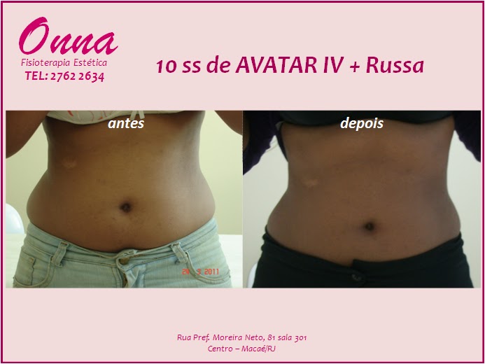 .: AVATAR IV + Corrente Russa