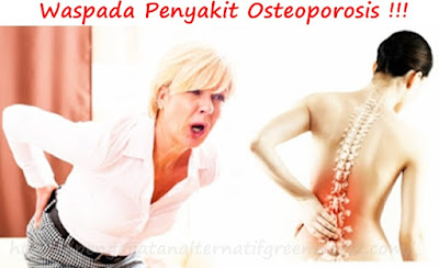 obat osteoporosis herbal