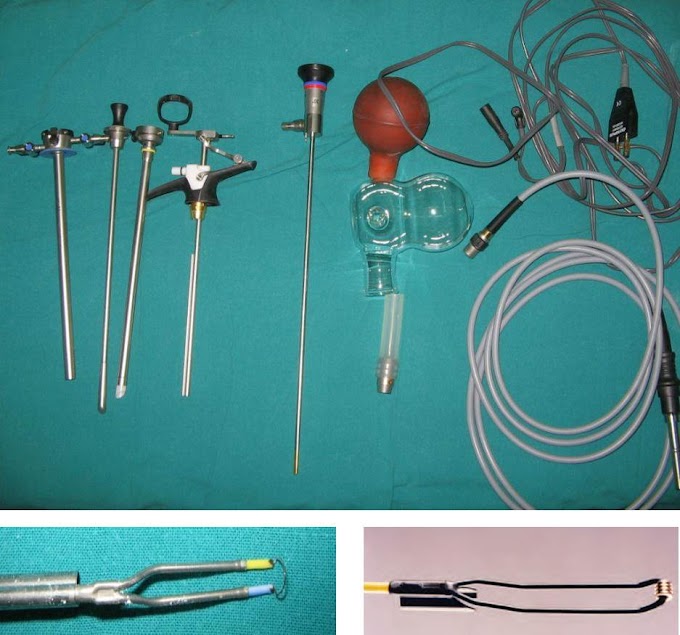 Vesicovaginal fistula evaluation presentation