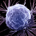Учени твърдят, че са открили "Ахилесовата пета" на туморите
