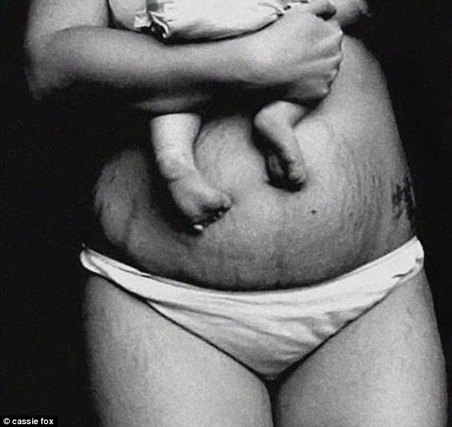 Sorry, Saggy stretch marks mom Saggy stretch marks mom was and