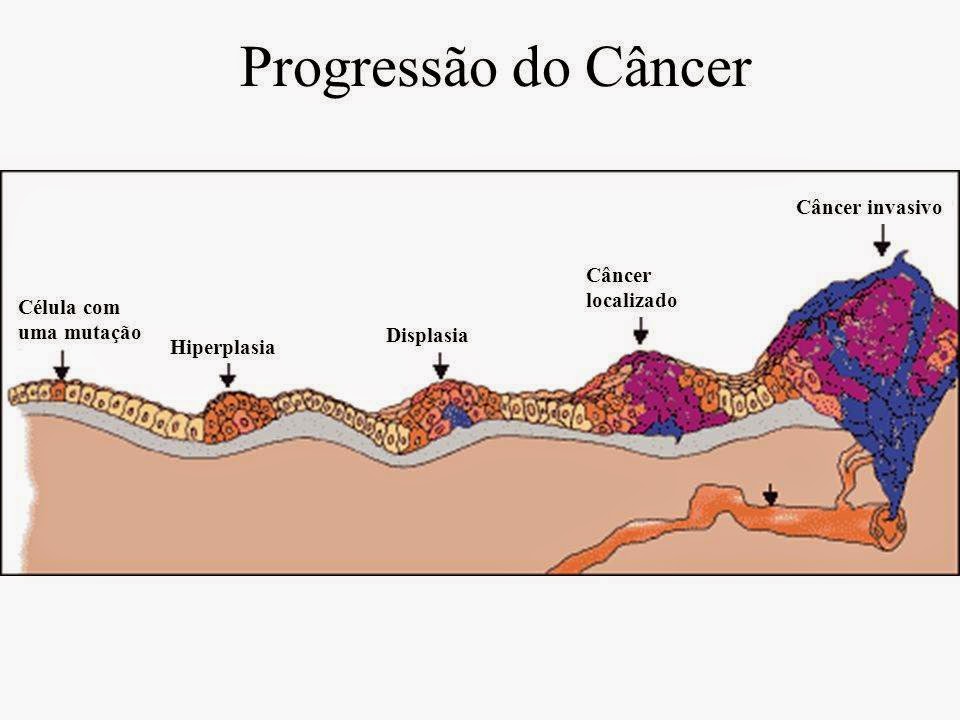 A Evolução Do Câncer Apresenta Três Diferentes Fases EDUKITA