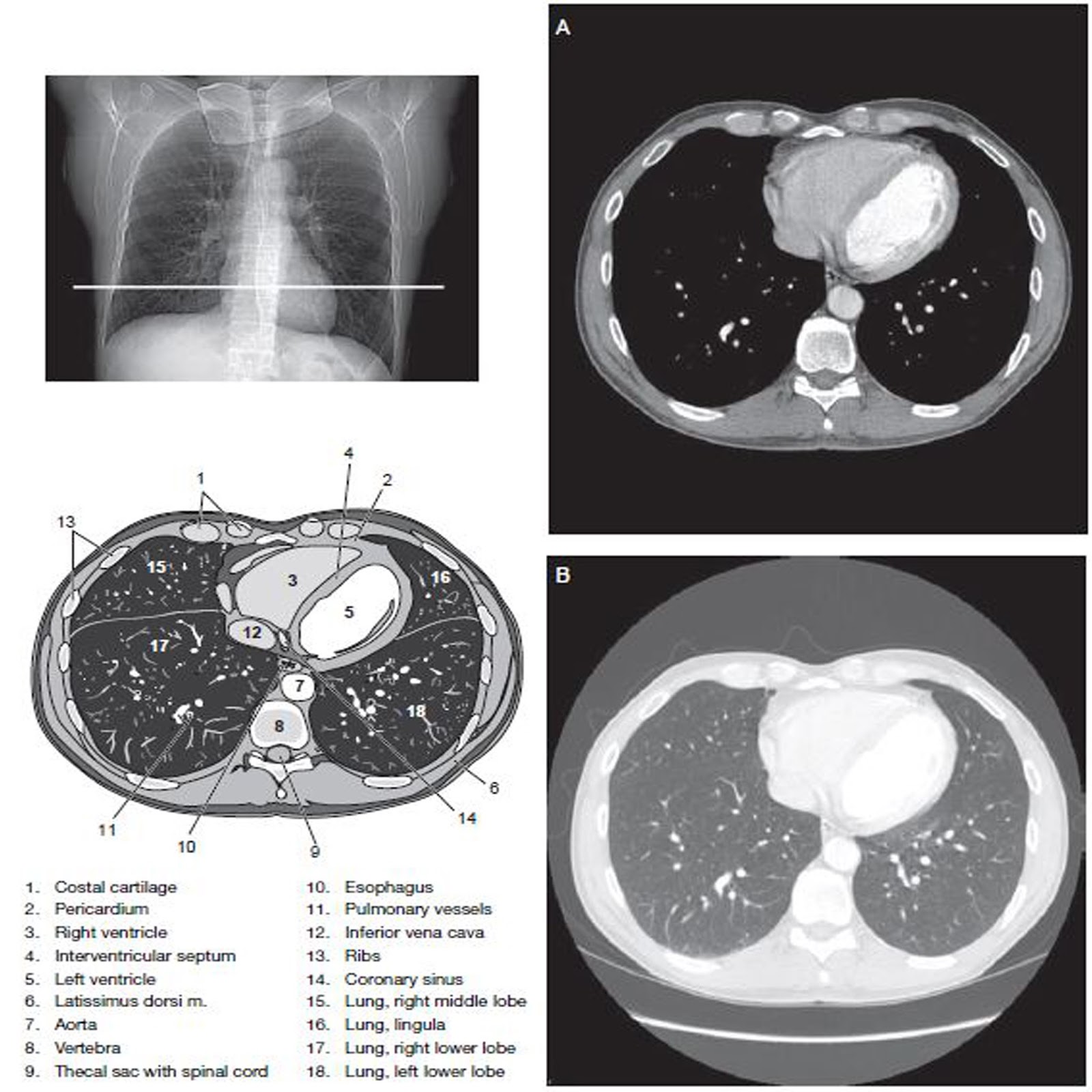 Chest CT Scan Imaging RadTechOnDuty