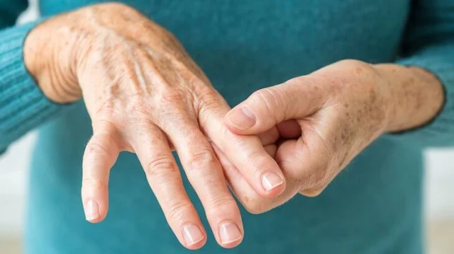 Tips-for-Living-with-Rheumatoid-Arthritis