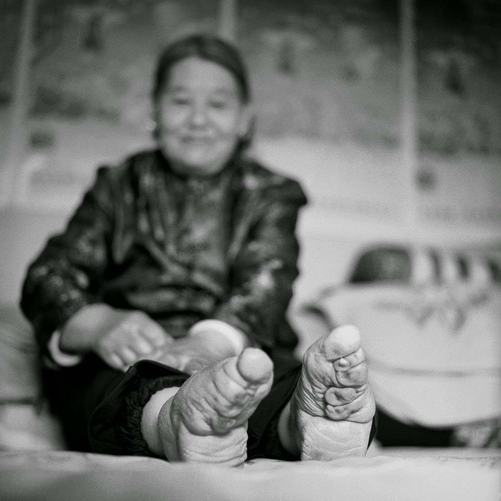 Deformutilation Foot Binding Part IV