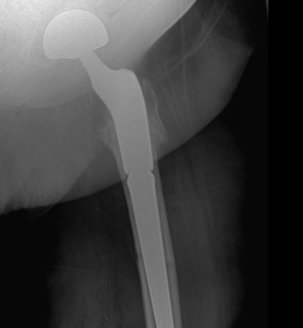 Interesting Topics in Orthopedic Surgery by Dr. Nasar