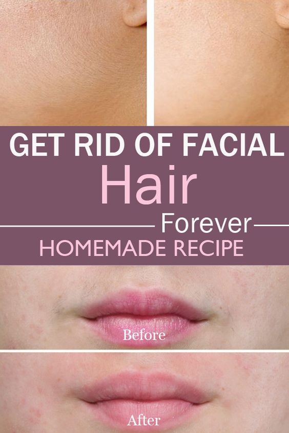 Tips For Her Home Remedy For Facial Hair
