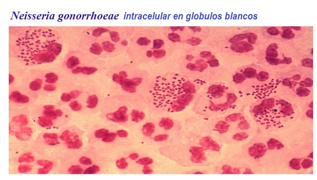 Гамма-гемолитические стрептококки на кровяном агаре. Стрептококк нейссерия. Стрептококк нейссерия. Микроорганизмы вызывающие менингит. Микроорганизмы гонококки диплококки.