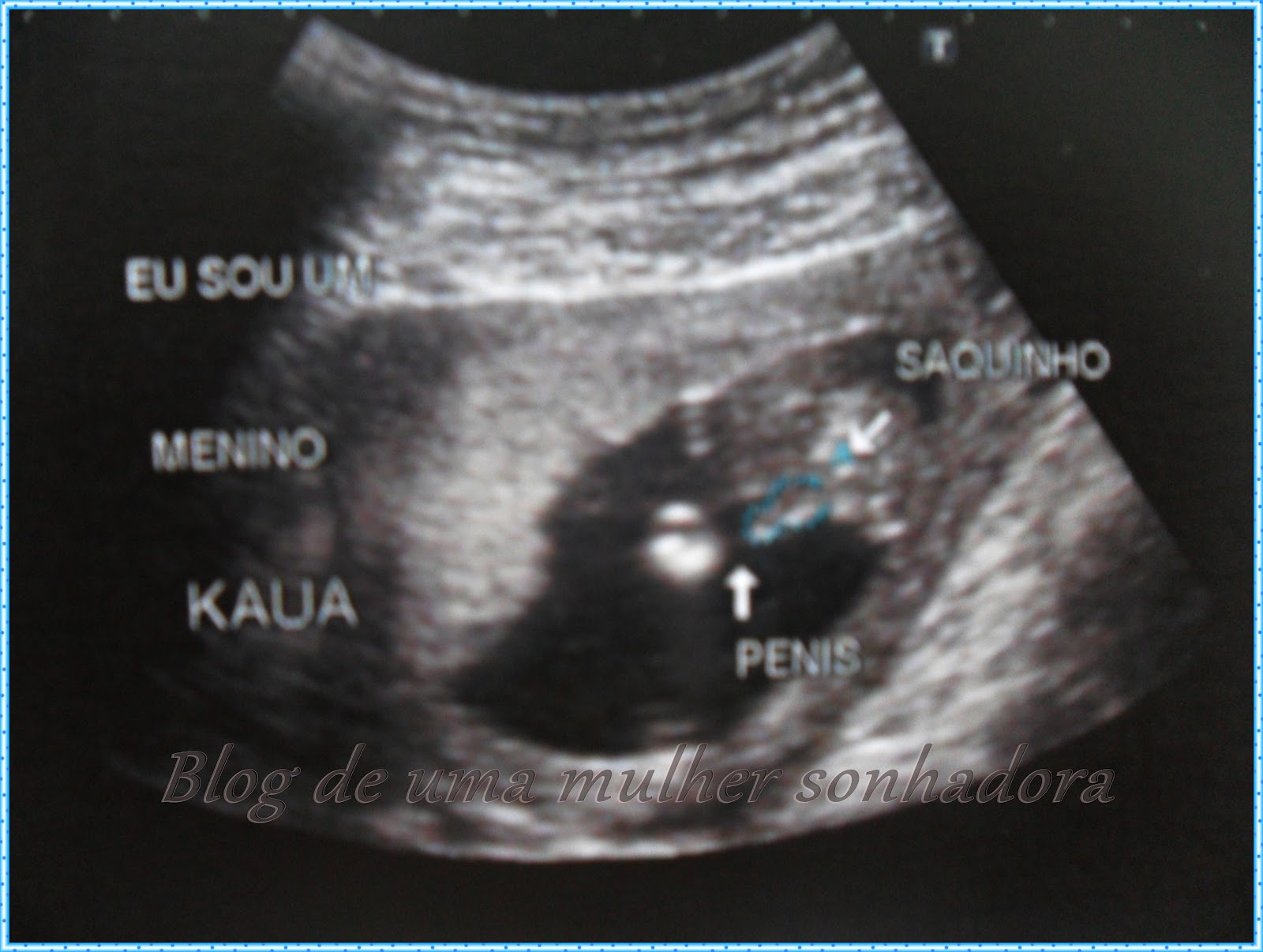.: 3ª Ultrassonografia do bebê + foto da barriga de 4 meses...