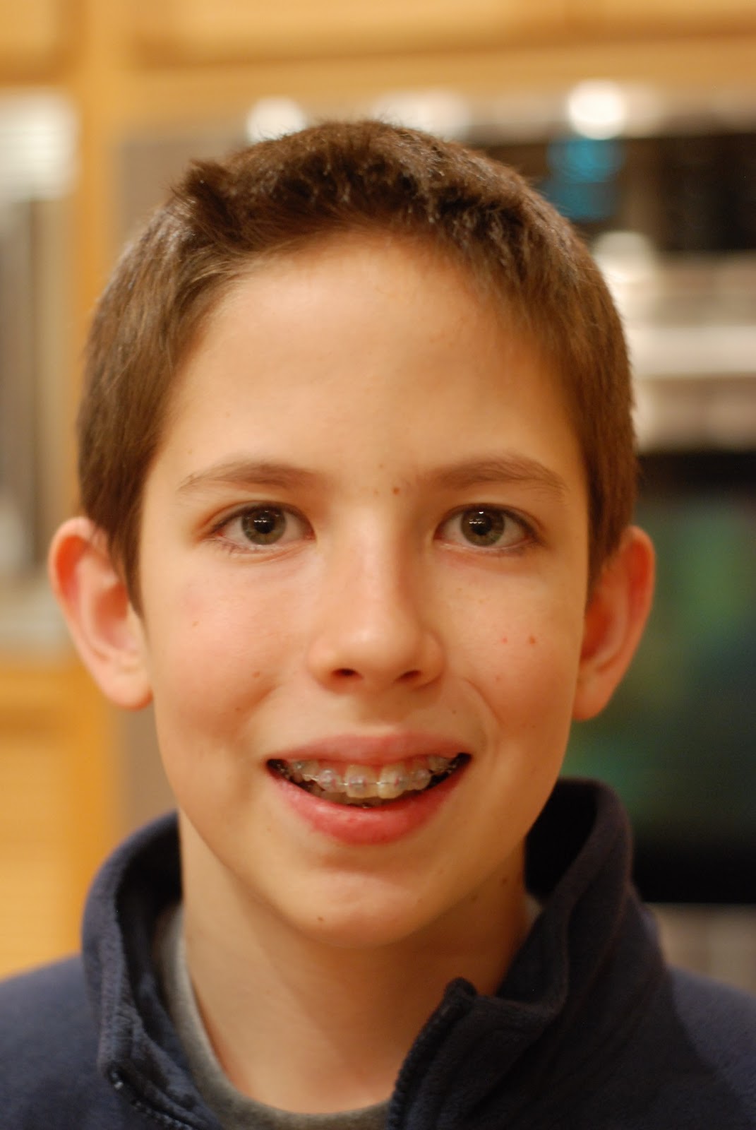 Moss Moments 14 and braces.