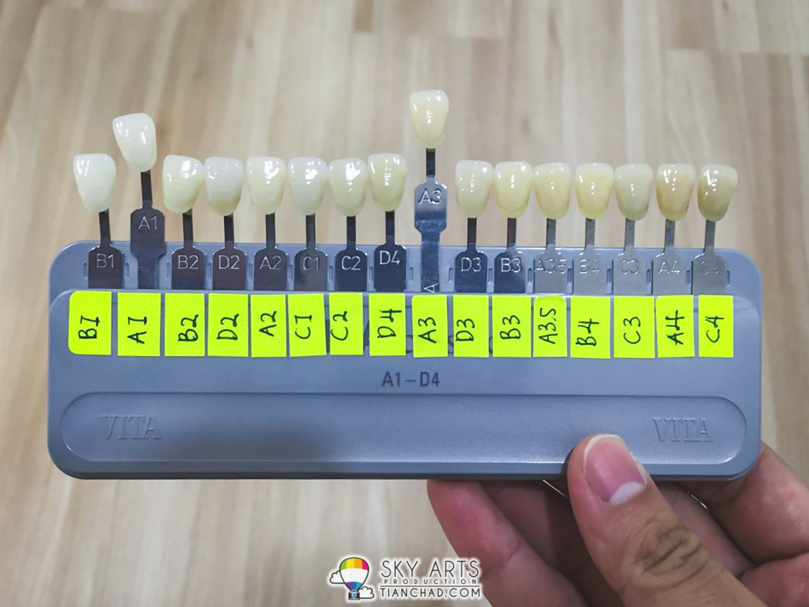 Laser Teeth Whitening M Dental Clinic Damansara Utama