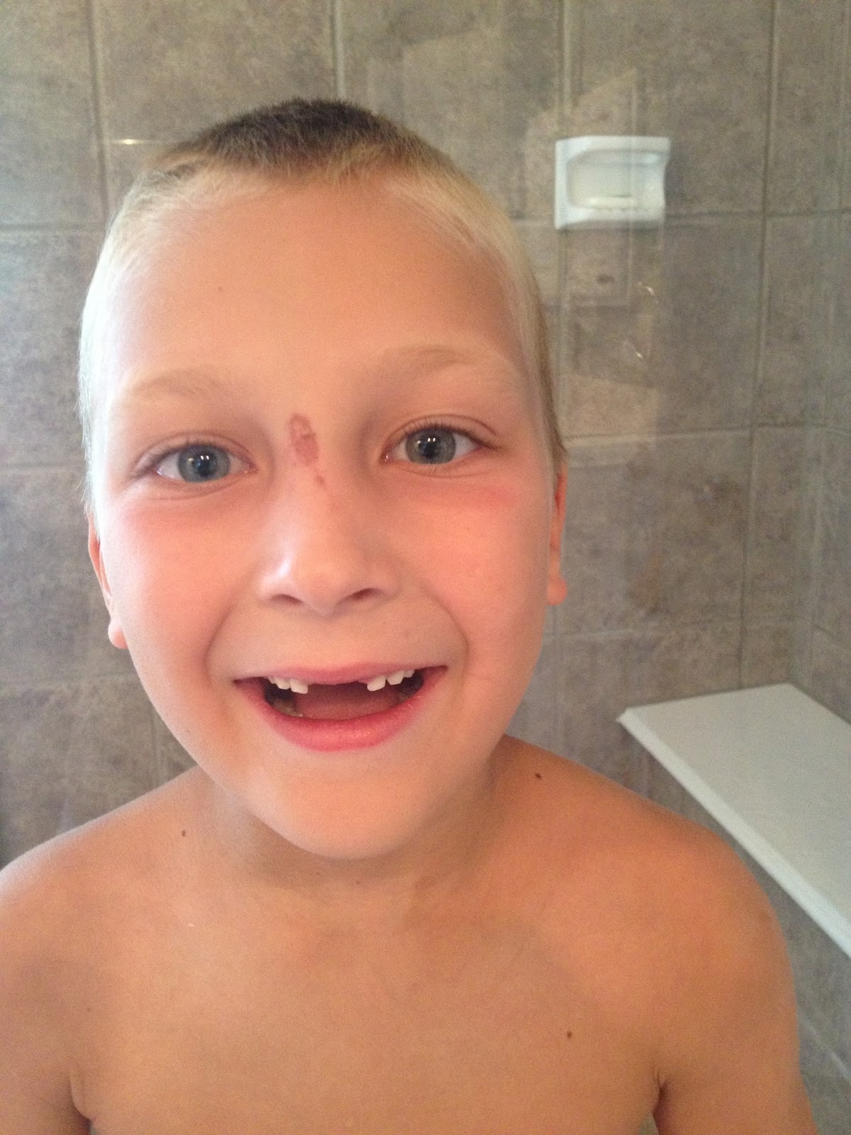 august scraped success fall head tooth