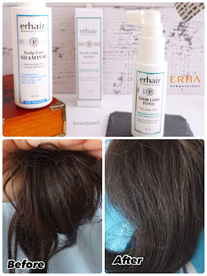 hasil-pemakaian-erha-erhair-perawatan-rambut.jpg hasil-pemakaian-erha-erhair-perawatan-rambut.jpg