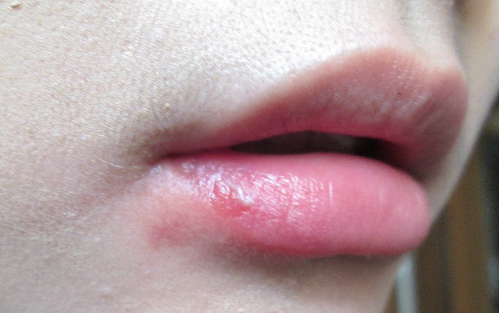 joy-s-commentary-ouch-burned-lip