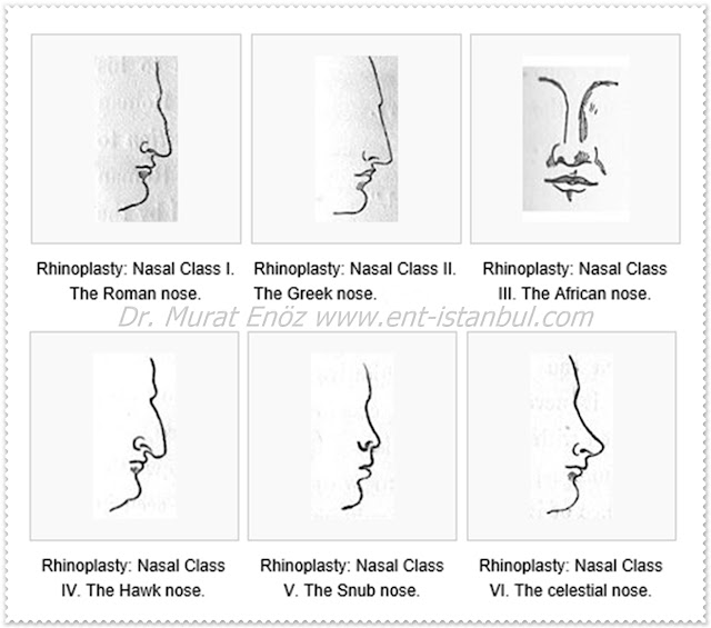 Rhinoplasty in Istanbul - Nose Reshaping - Nose Job Istanbul - Nose Aesthetic Istanbul - Nose Cosmetic Surgery in Turkey - Nose surgery Istanbul - Rhinoplasty in Istanbul - Open Rhinoplasty in Turkey - Septorhinoplasty in Istanbul - Nose job in Turkey