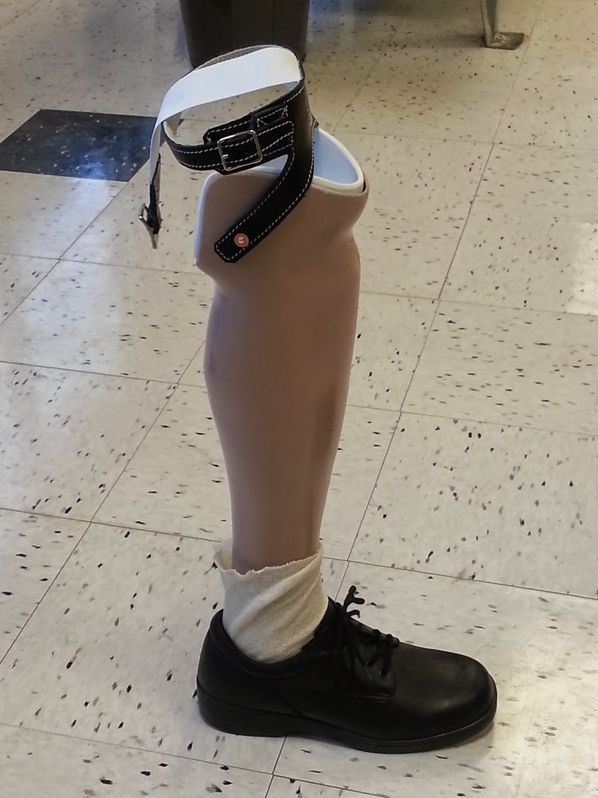 Prosthetic Projects PTB Exoskeletal Prosthesis