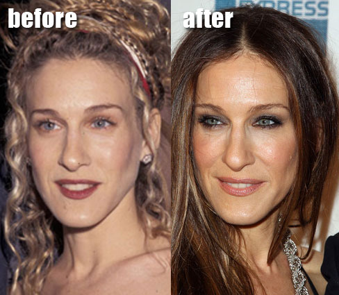 Sarah jessica parker plastic surgery.