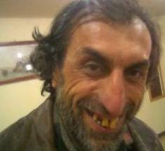 Man with bad teeth