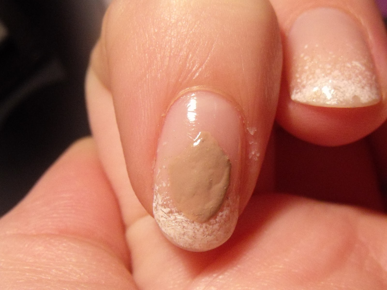 múmia kezelés nail gombák flucostat és körömgomba