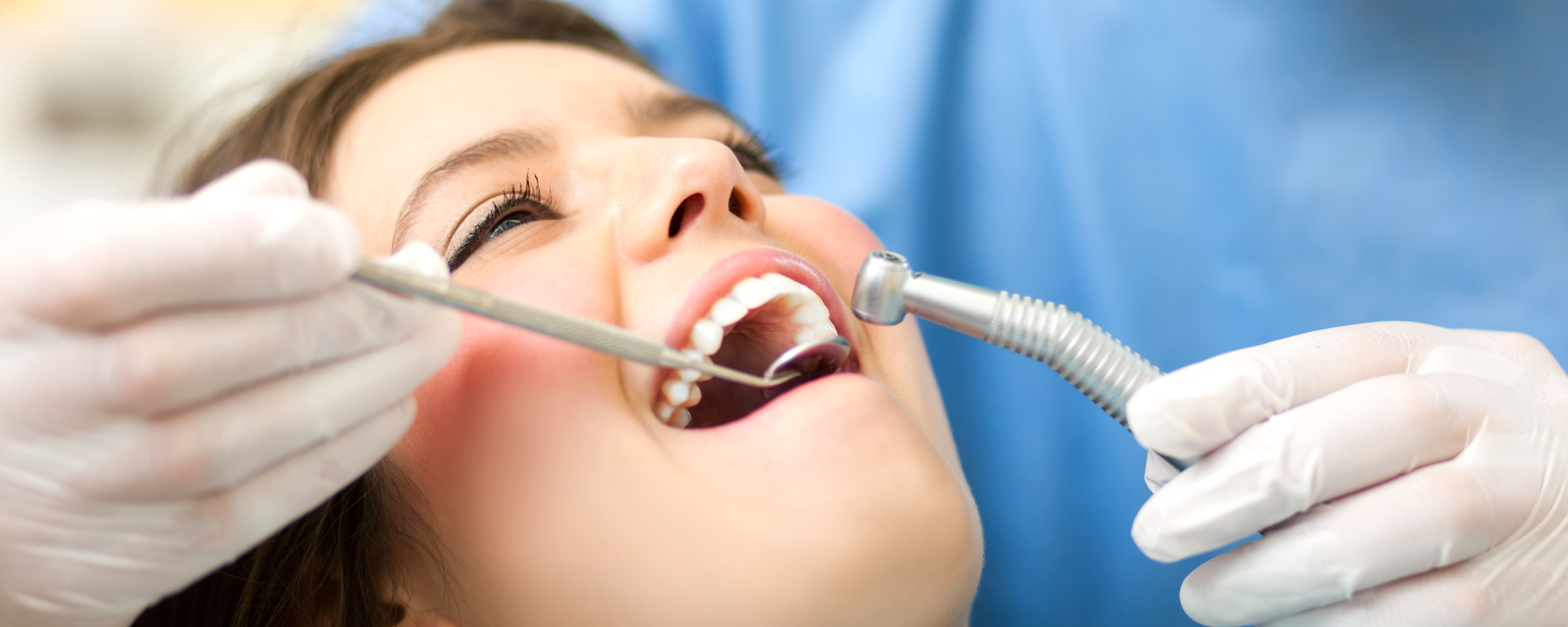 Professional Dental Care Five Most Common Dental Problems