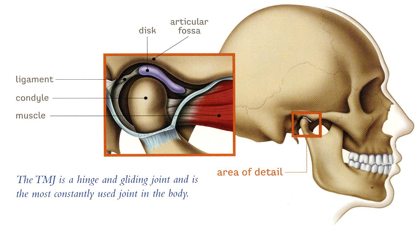 Temporomandibular Joint (TMJ) Disorder Overview