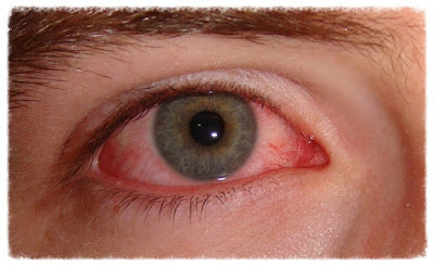 red eyes