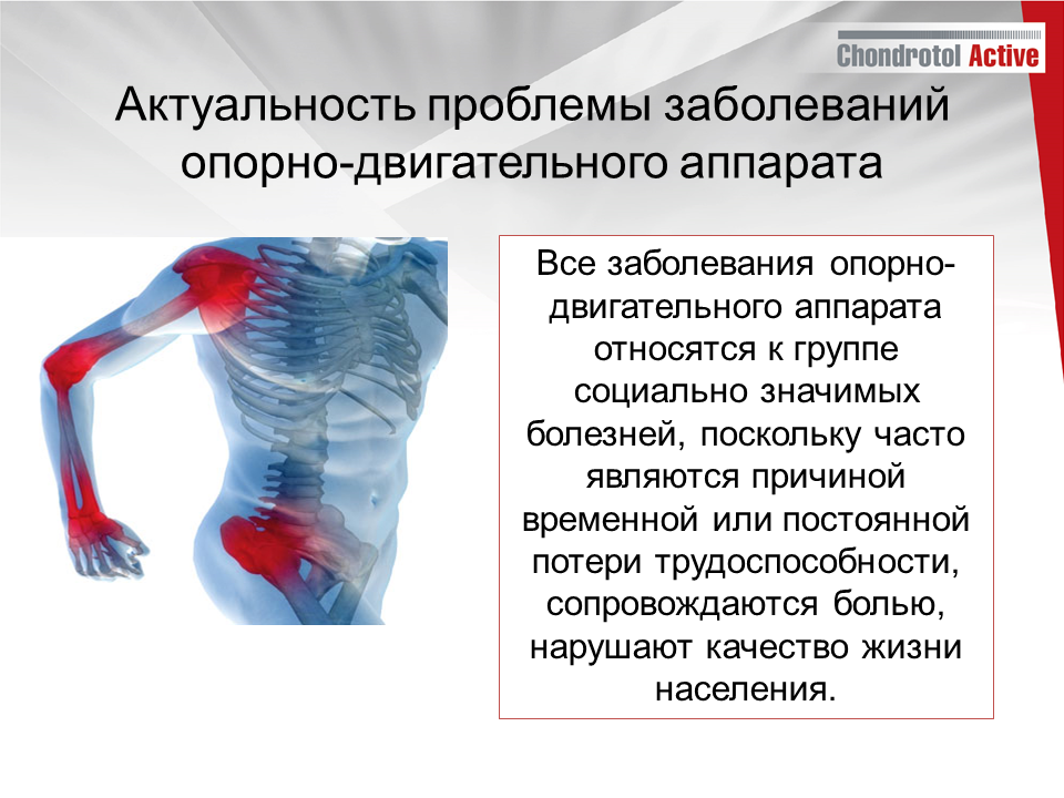 нарушение опорно двигательной системы. (детский церебральный паралич (дцп);полиомиелит. нарушения опорно двигательного аппарата при хромосомных болезнях. классификация нарушений опорно-двигательного аппарата у детей. причины нарушение опорно-двигательного аппарата таблица.