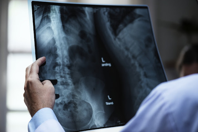 Image: Doctor Examines X-ray Film, by Raw Pixel on Pixabay