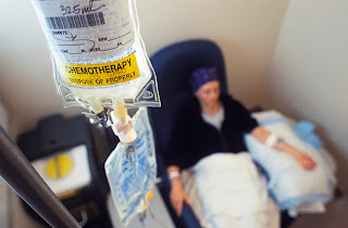 Chemotherapy Chemotherapy