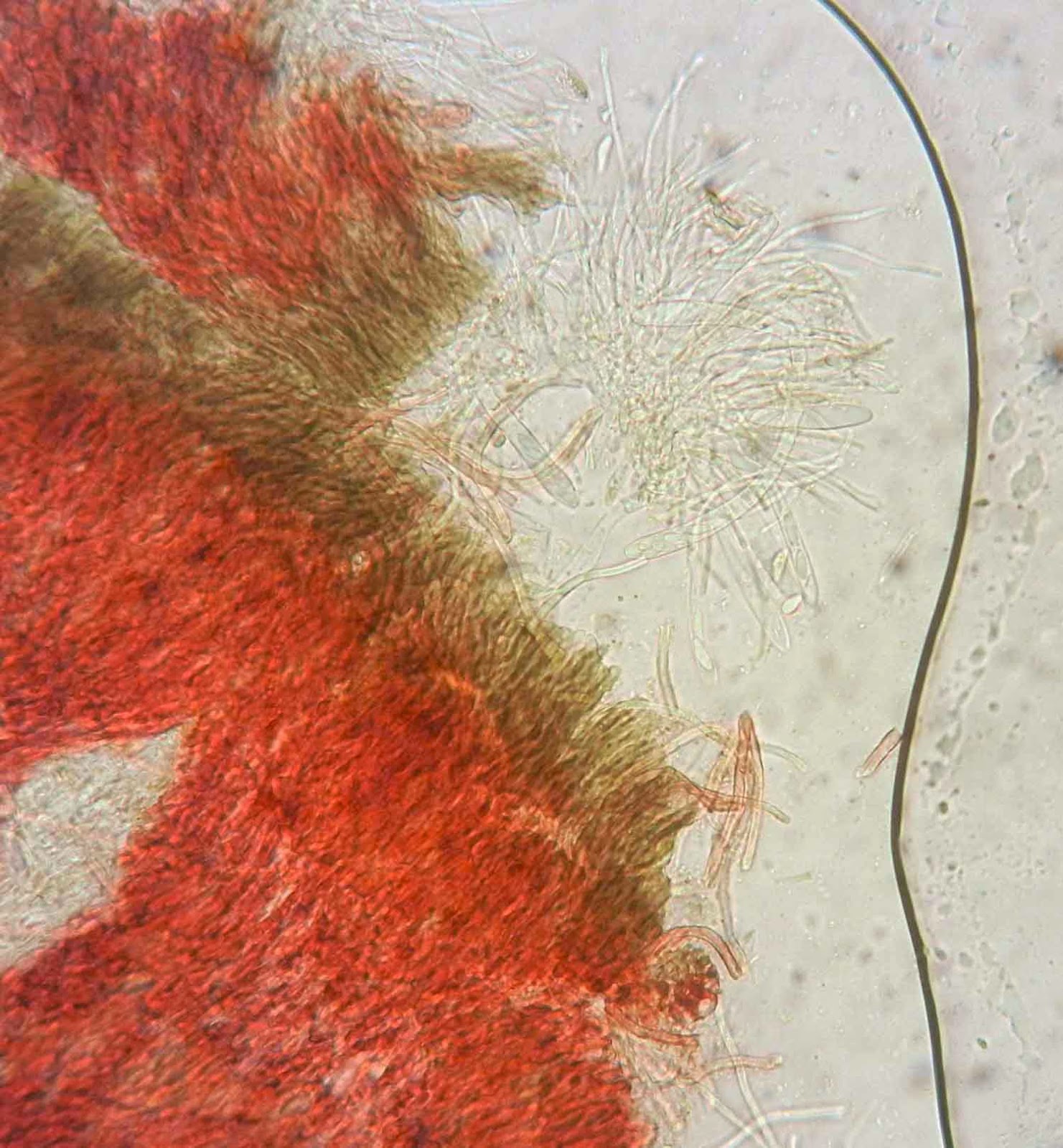 Patinellaria sanguinea microscopy Patinellaria sanguinea under microscope