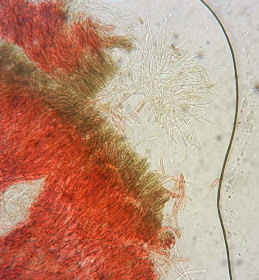 Patinellaria sanguinea under microscope